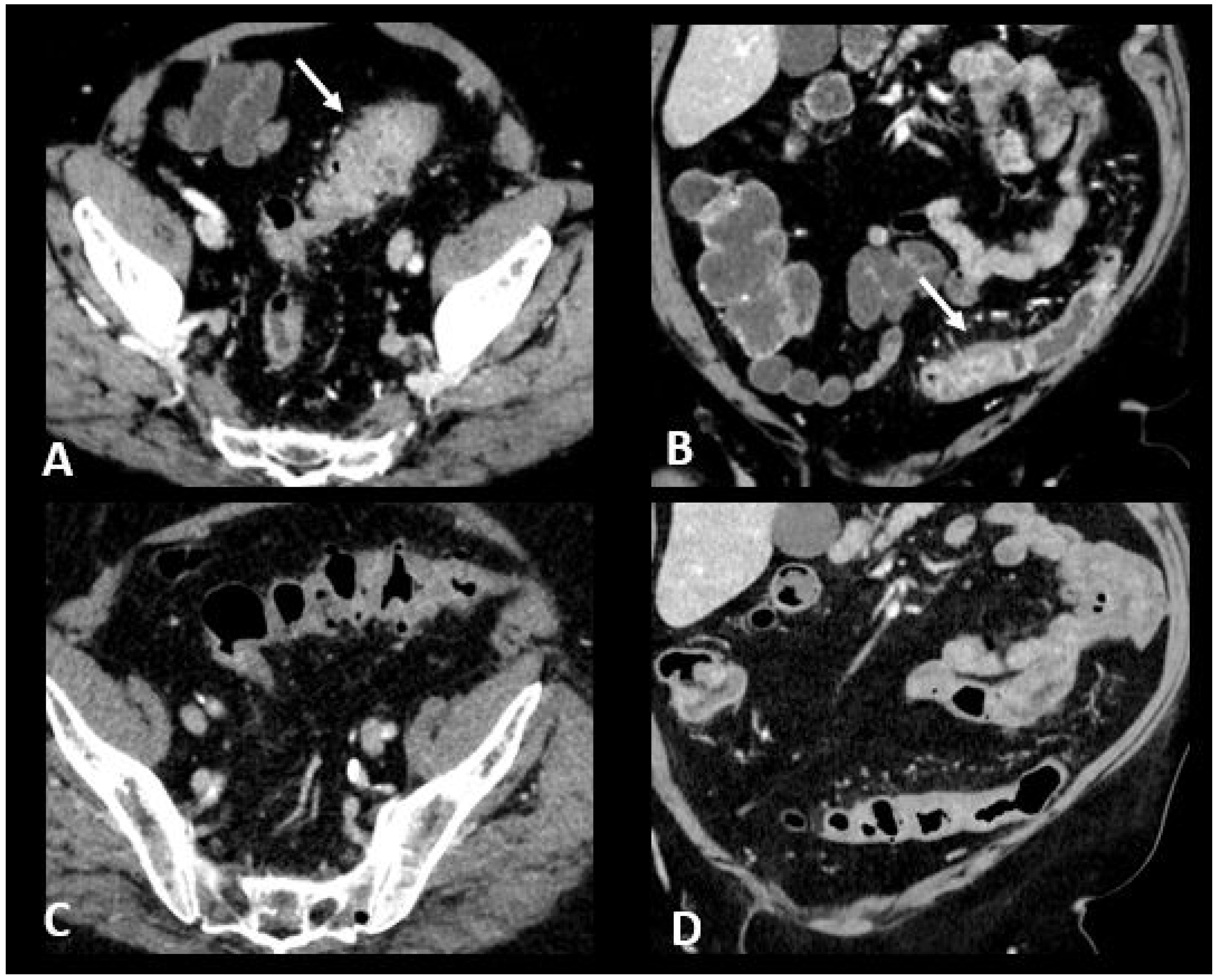 Cancers 16 02585 g006