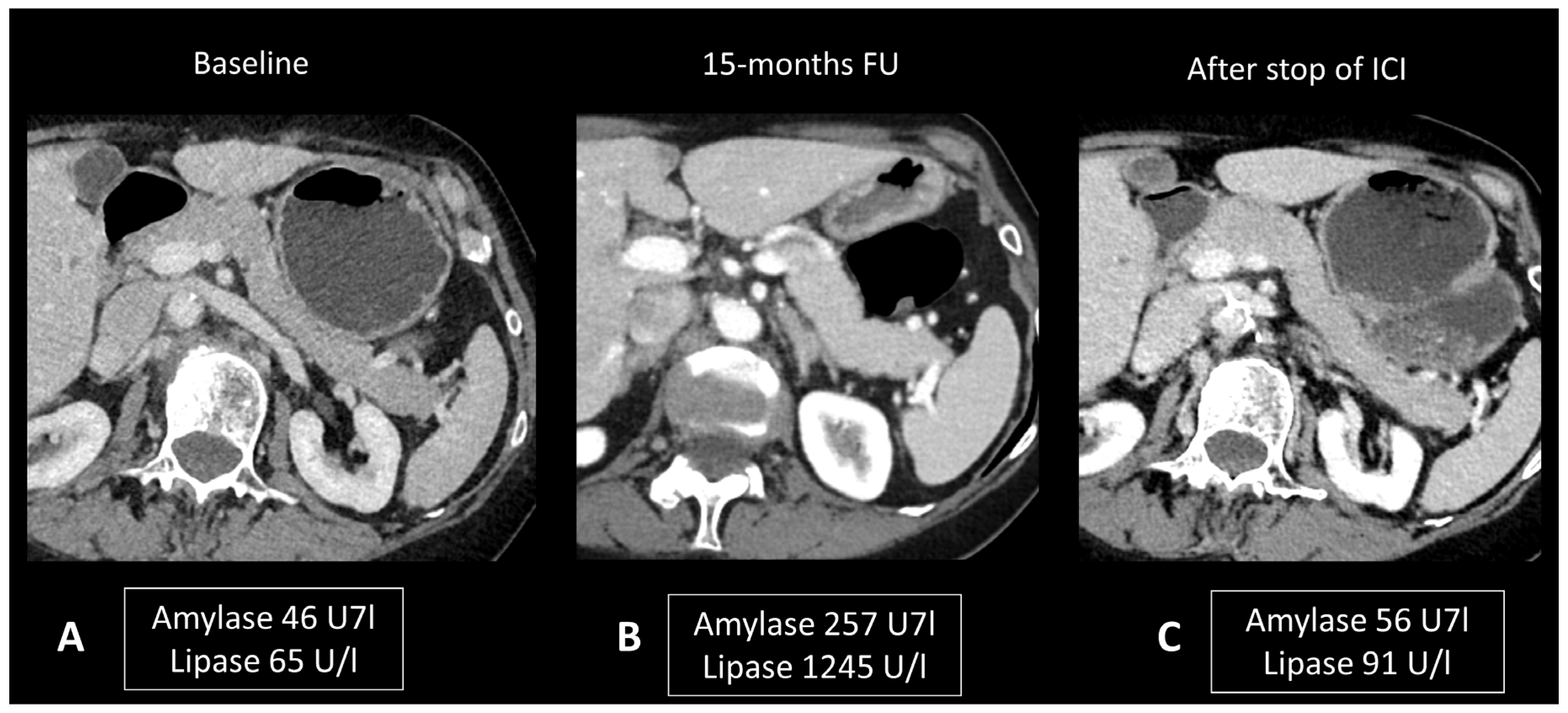 Cancers 16 02585 g007