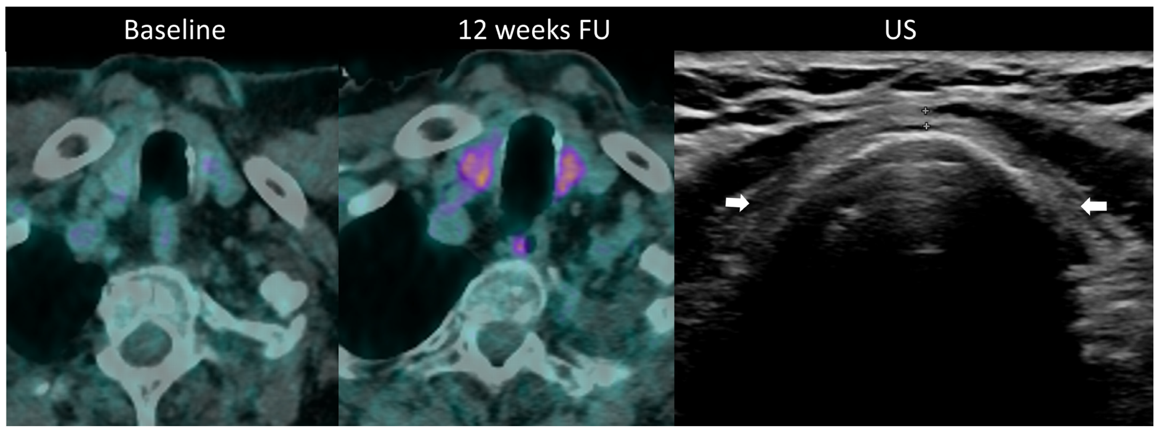 Cancers 16 02585 g010