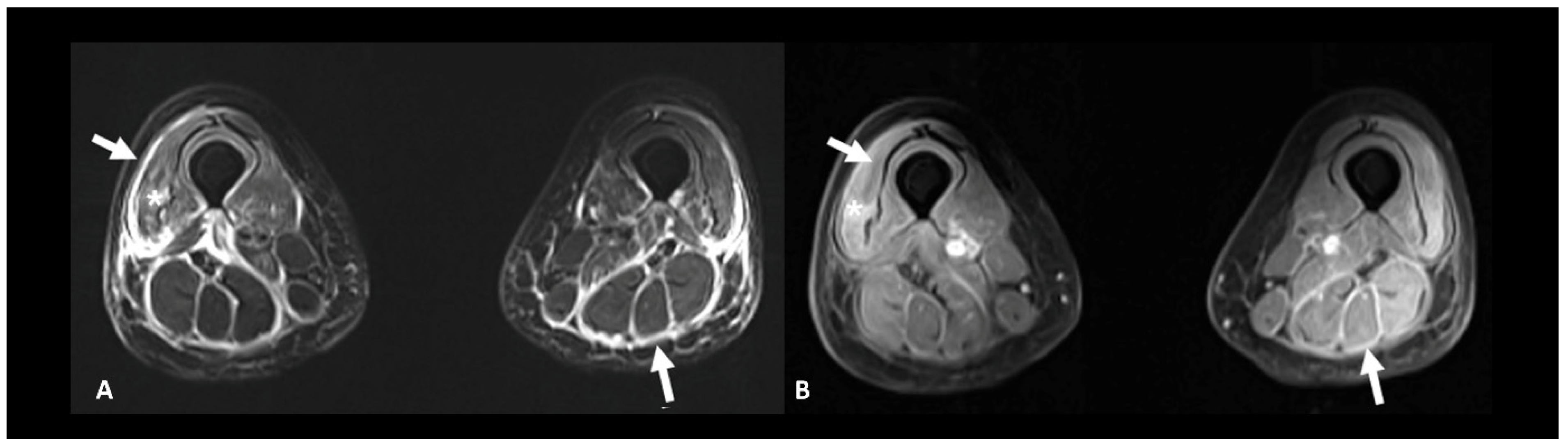 Cancers 16 02585 g012