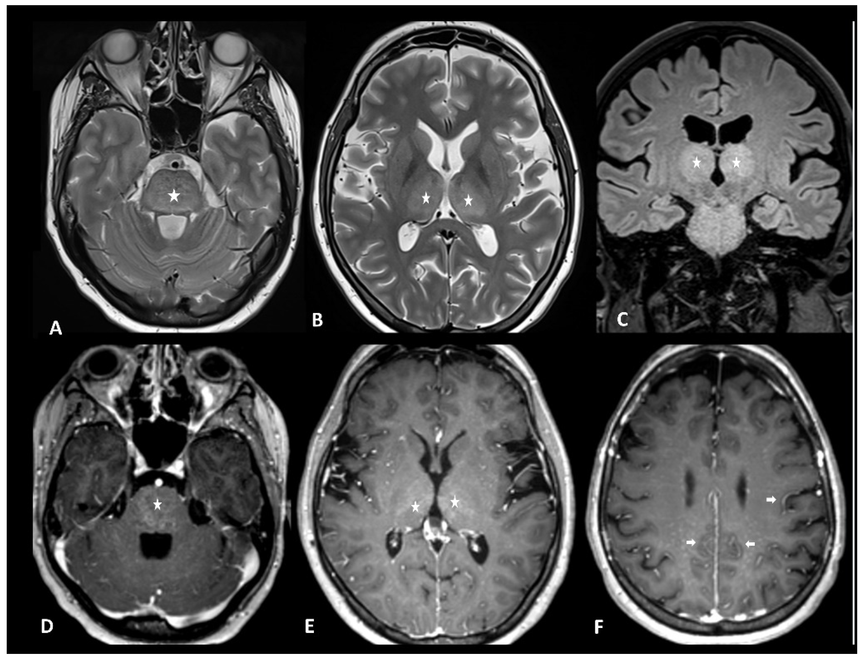 Cancers 16 02585 g013