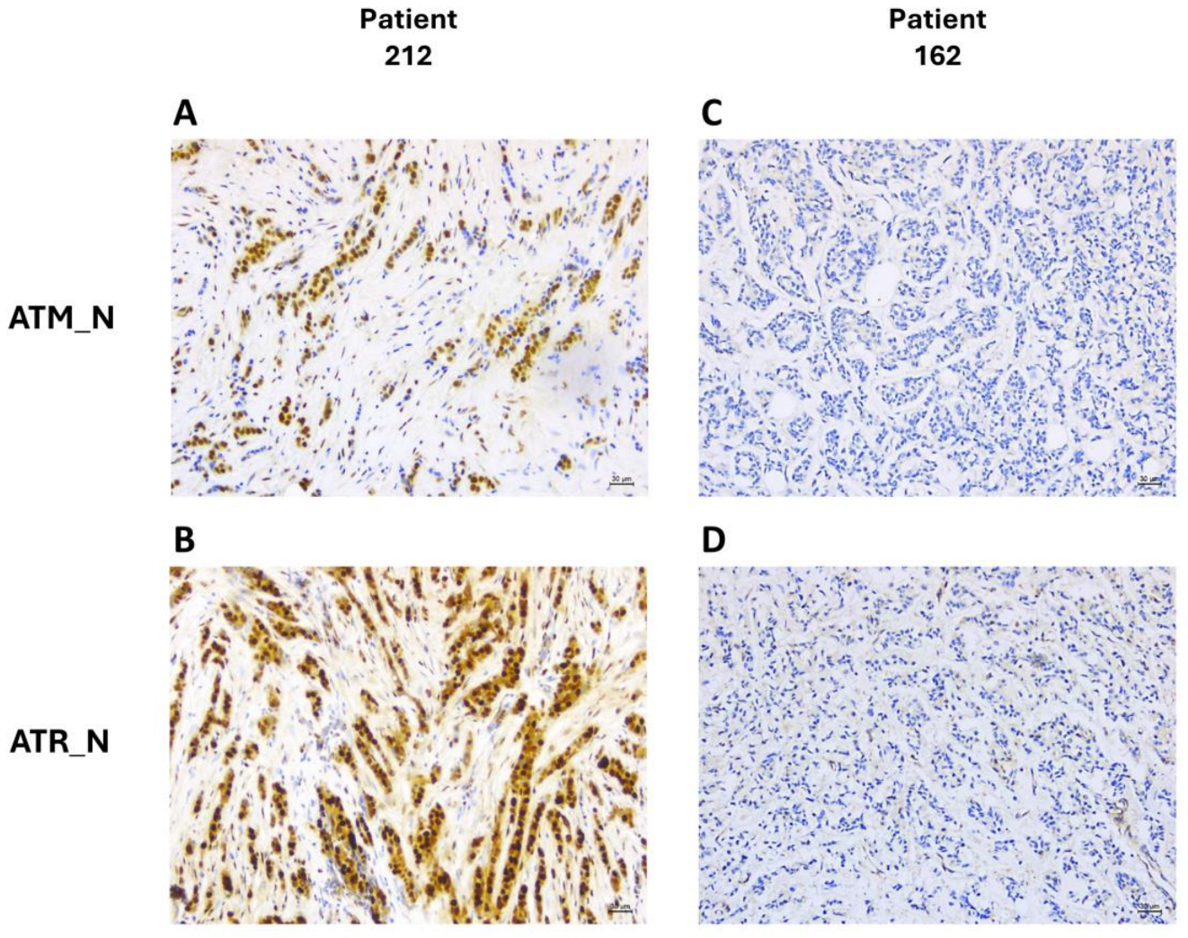 Cancers 16 02628 g007