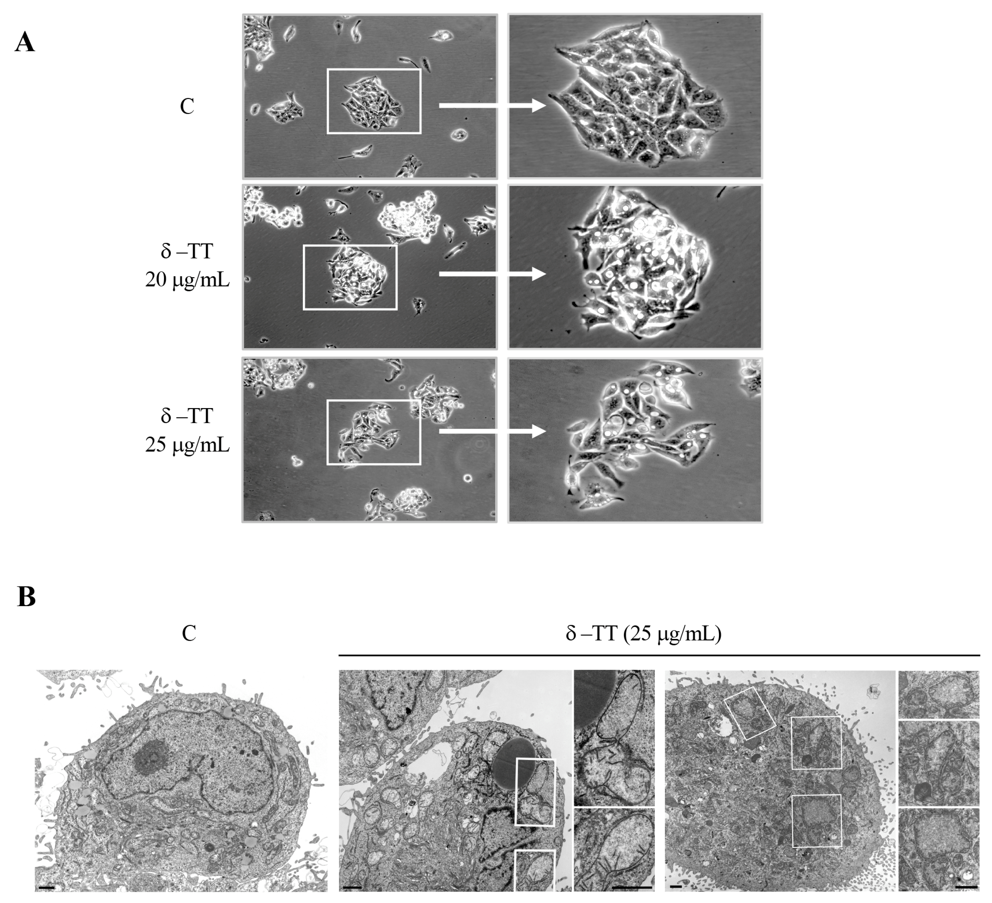 Cancers 16 02654 g002