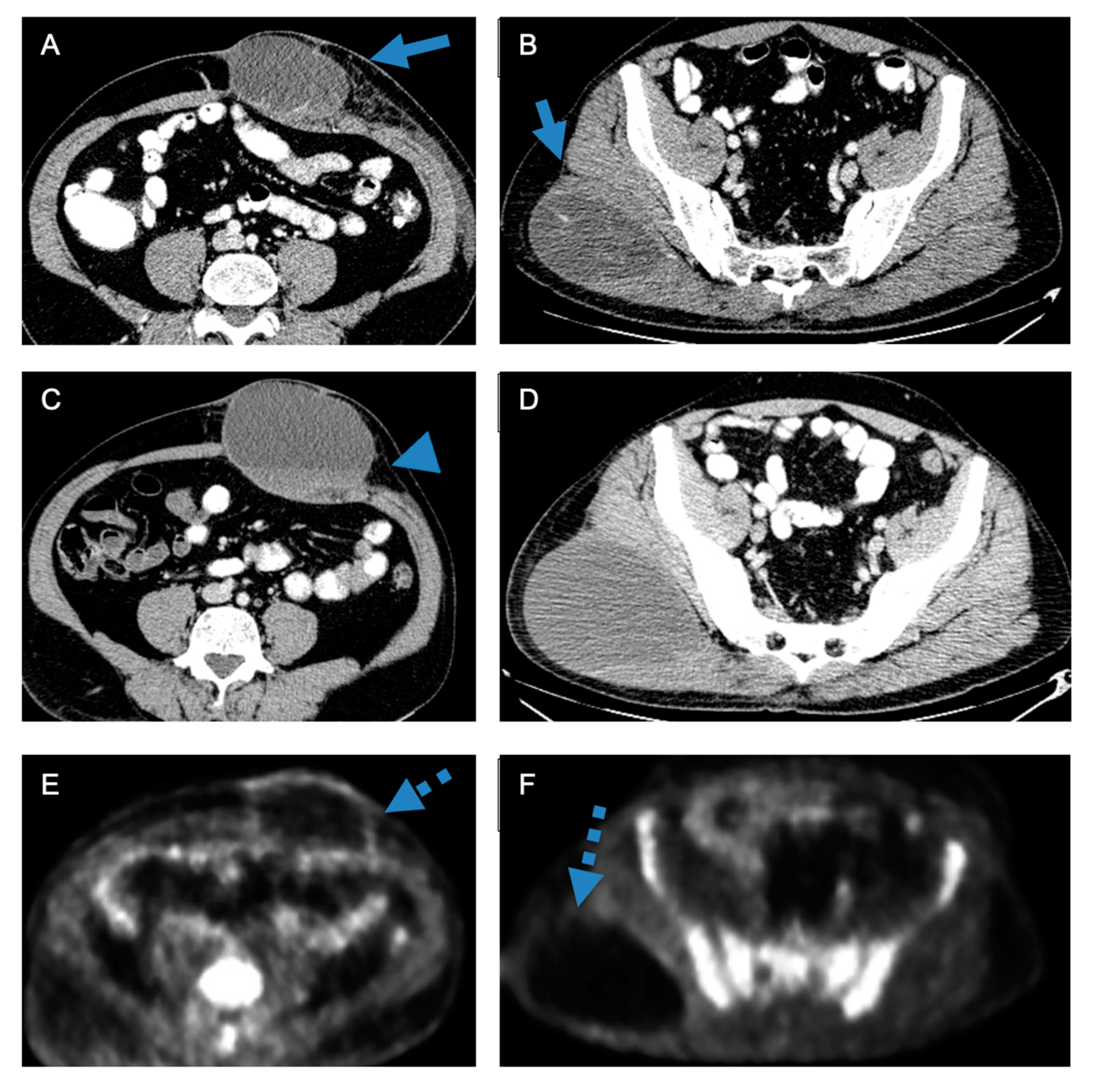Cancers 16 02674 g002