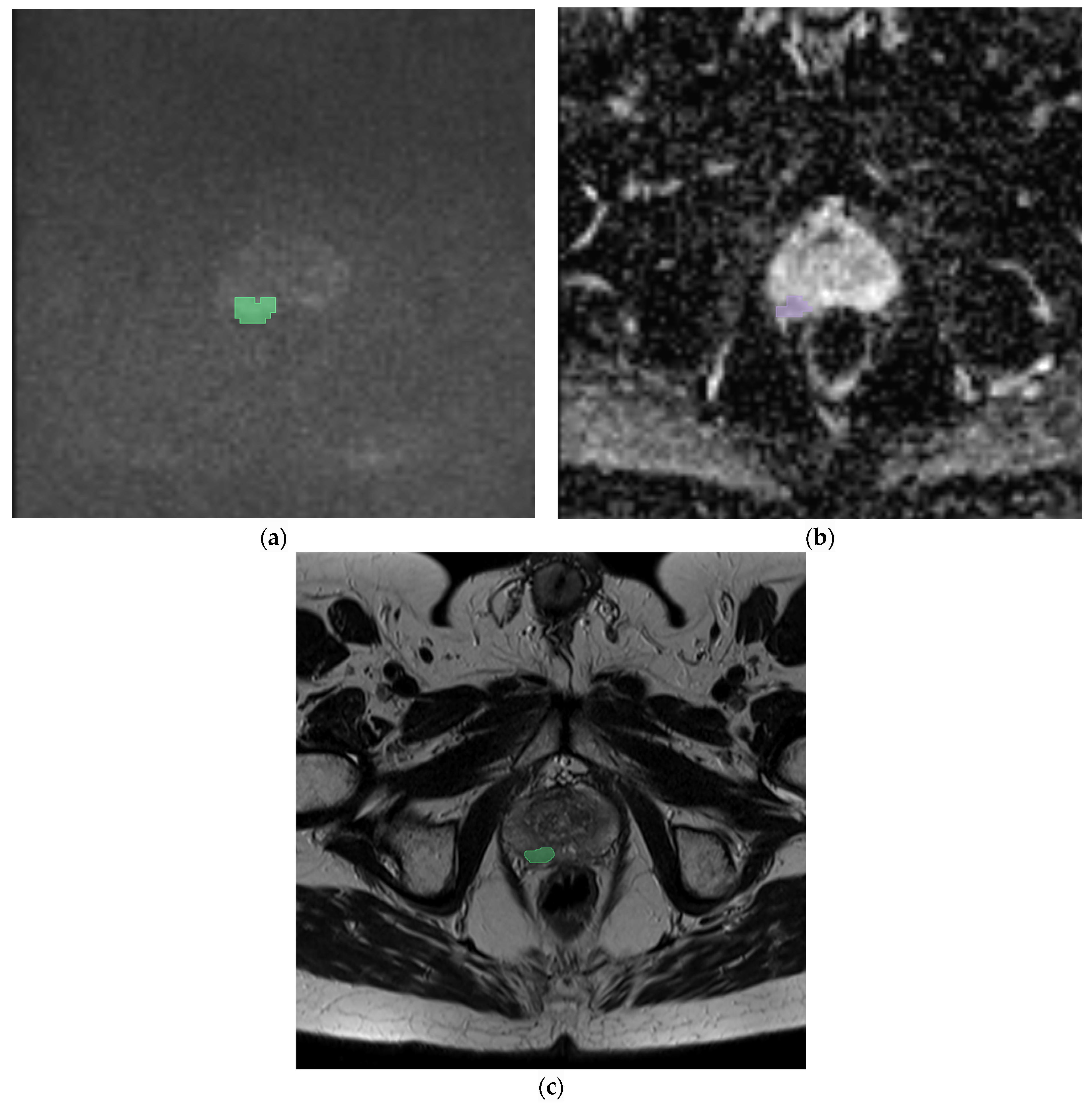 Cancers 16 02731 g002