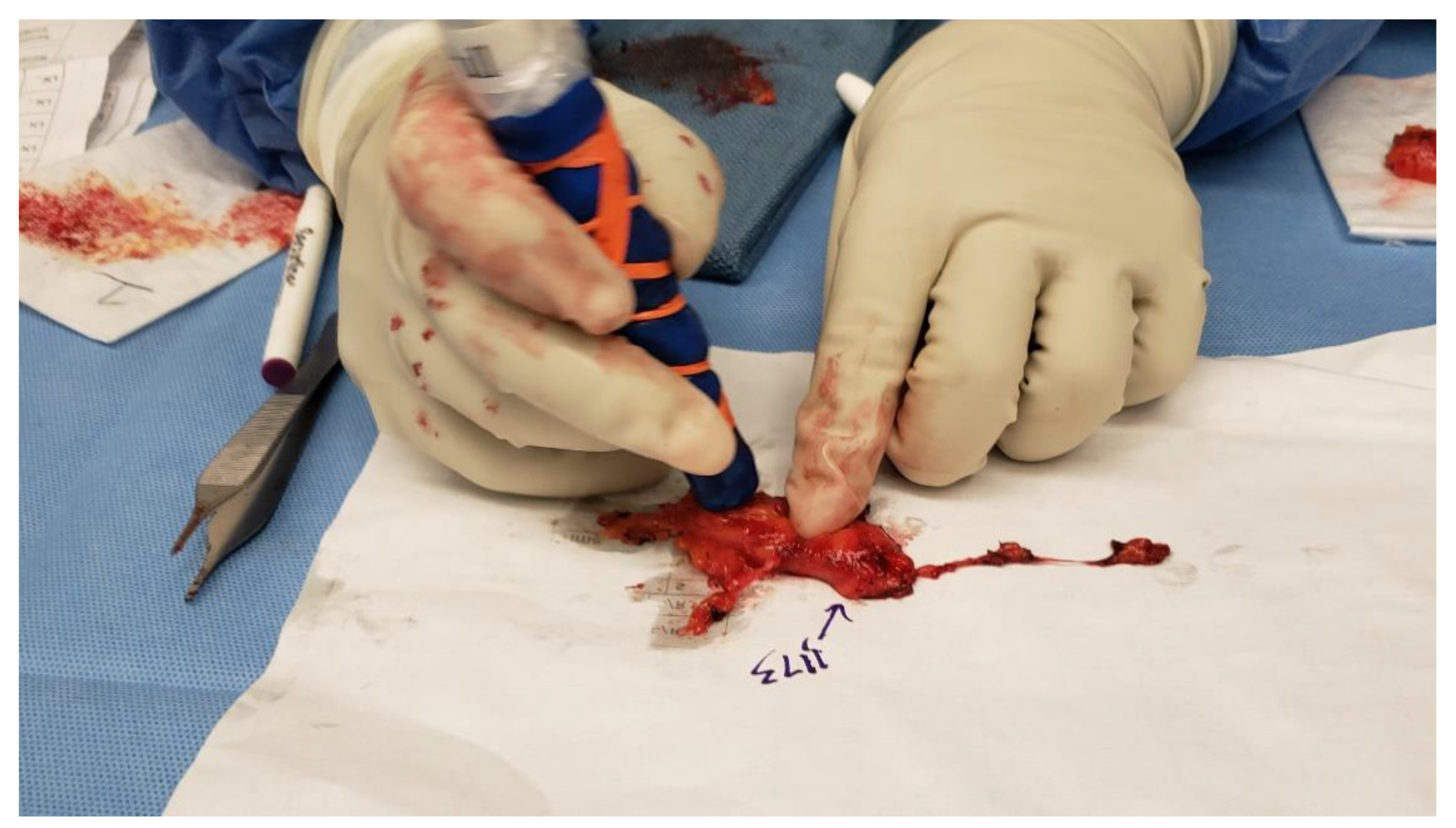 Cancers 16 02767 g003 Cancers 16 02767 g003