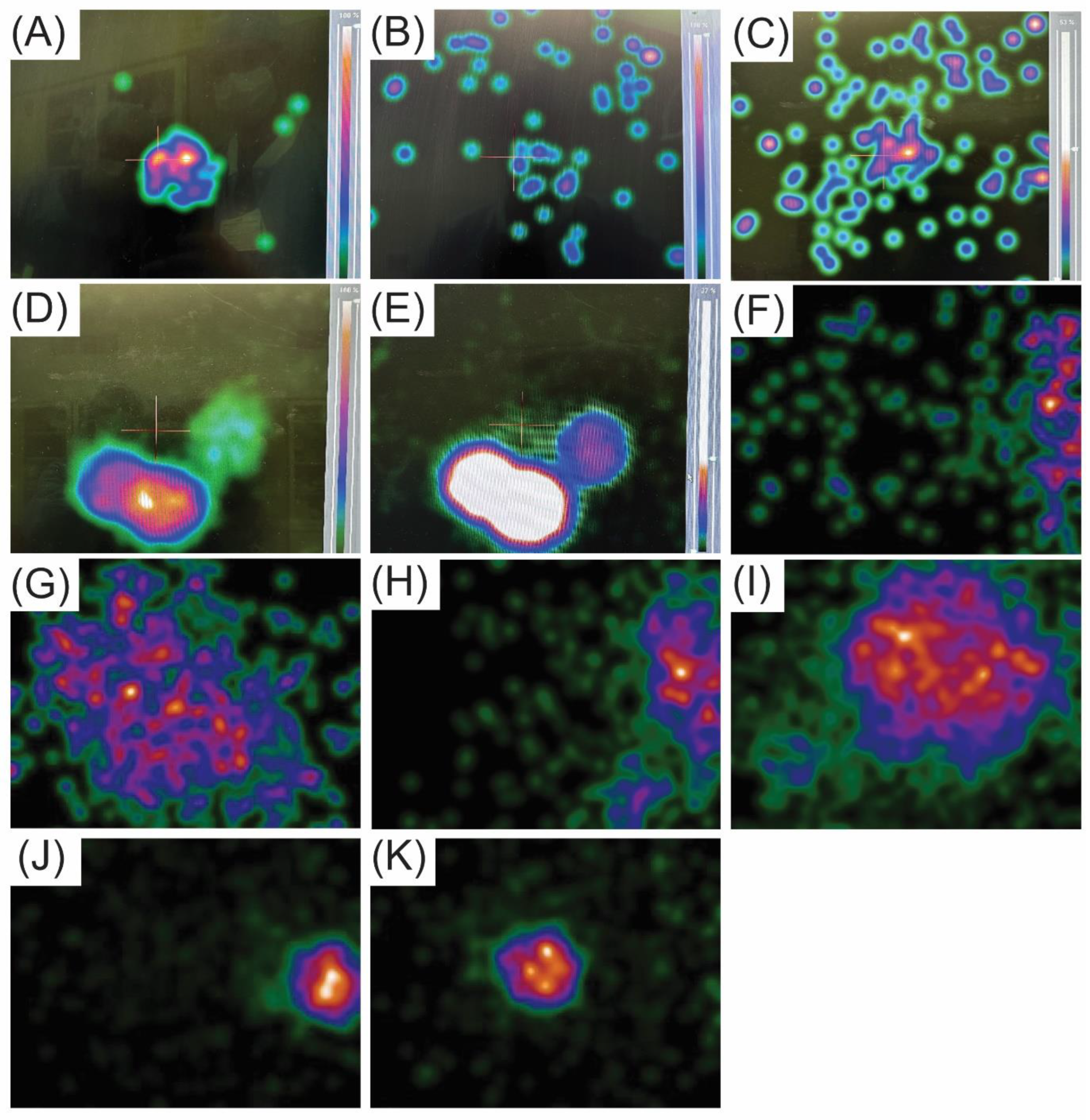 Cancers 16 02767 g005 Cancers 16 02767 g005