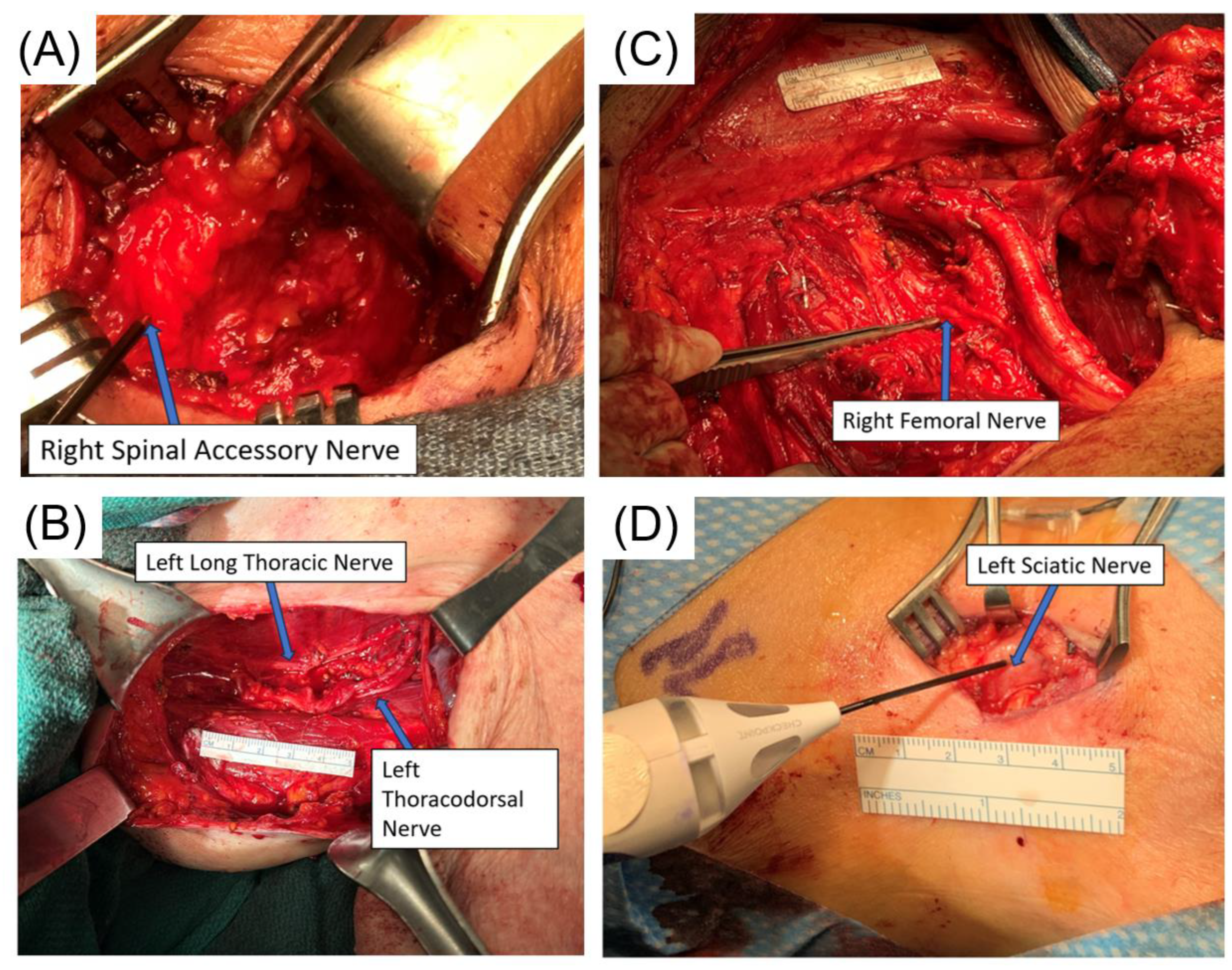 Cancers 16 02767 g006 Cancers 16 02767 g006