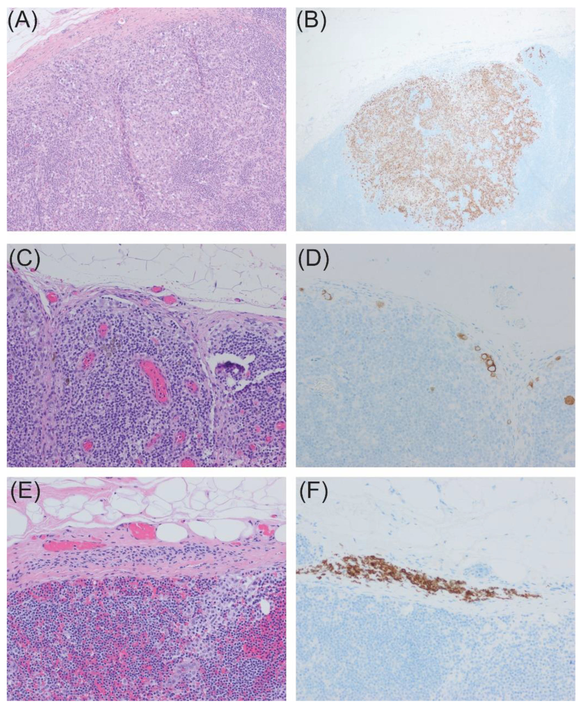 Cancers 16 02767 g009 Cancers 16 02767 g009