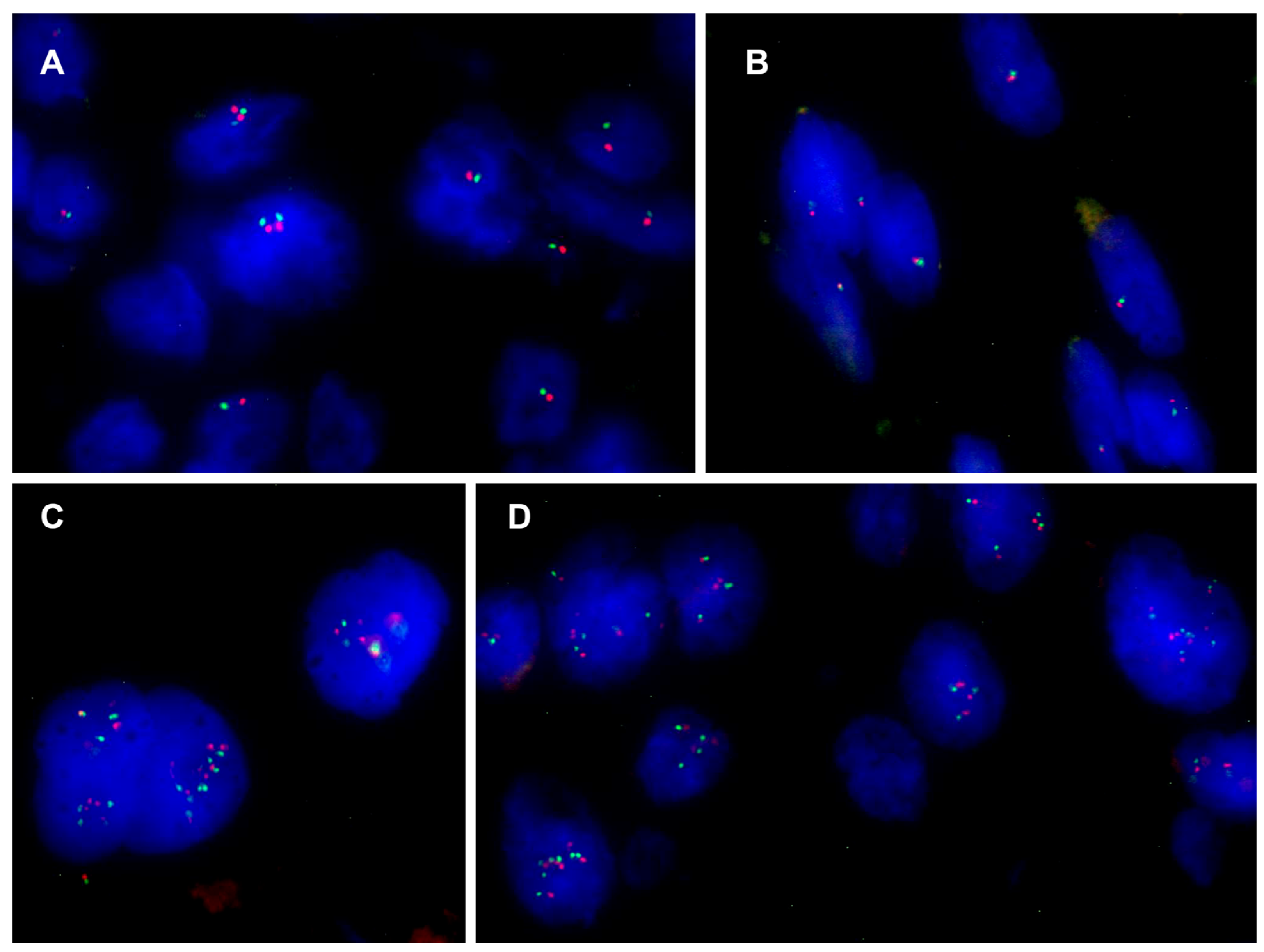 Cancers 16 02808 g003