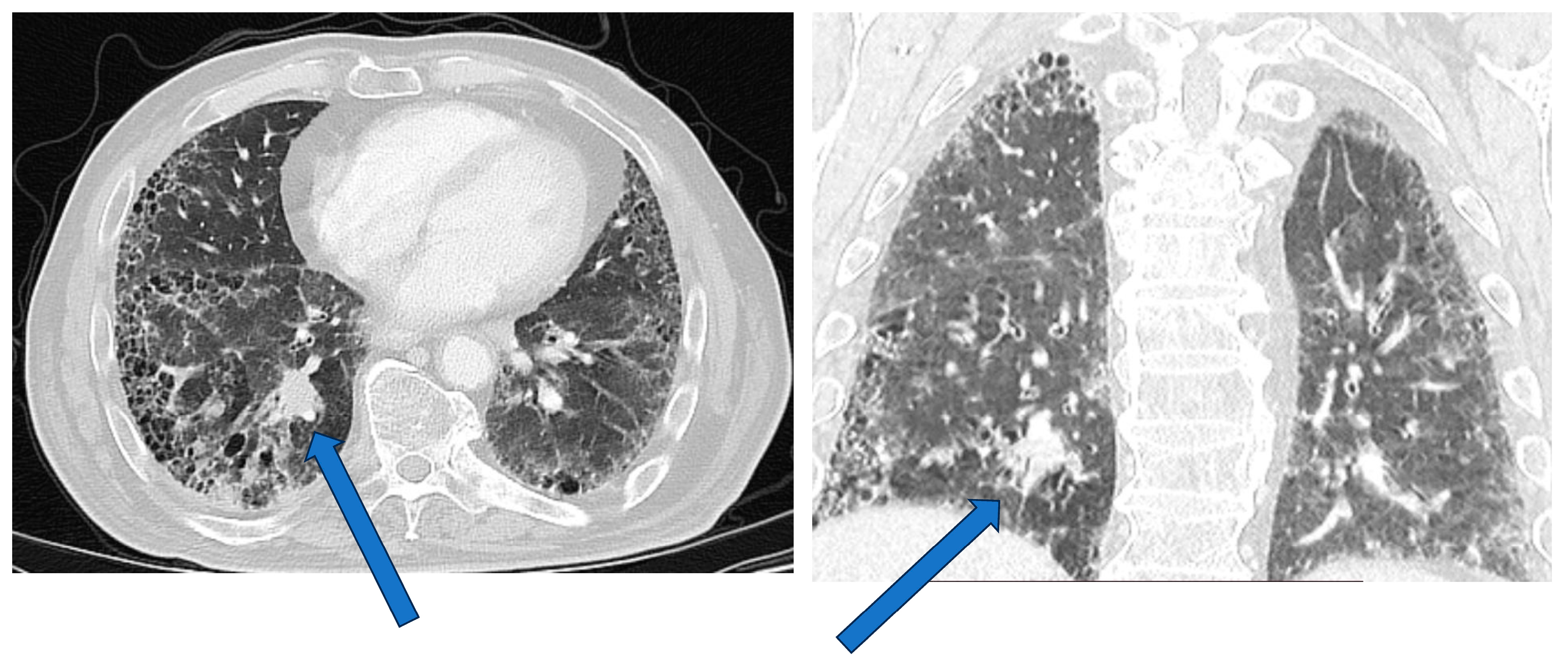 Cancers 16 02837 g001 Cancers 16 02837 g001