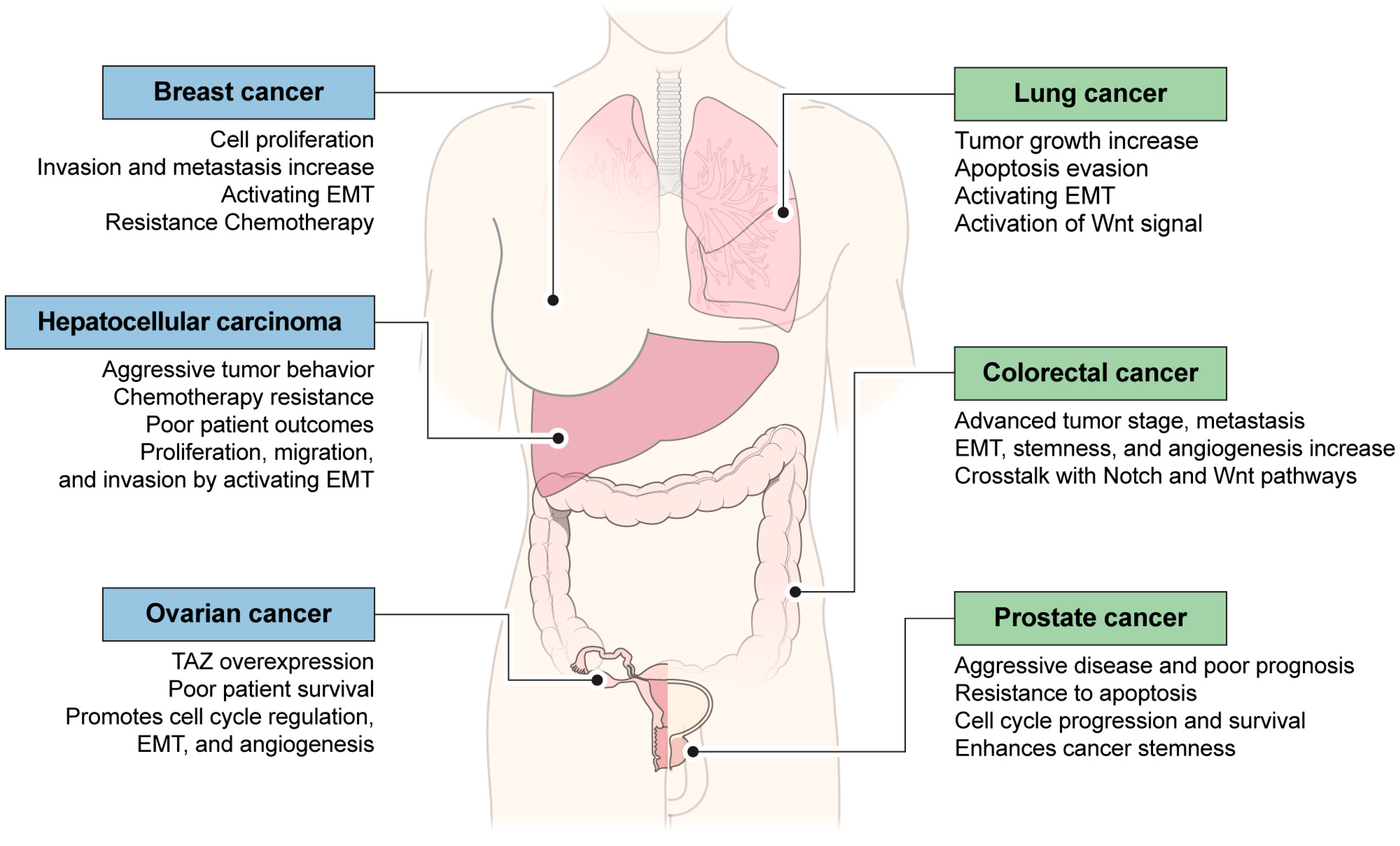 Cancers 16 03030 g002
