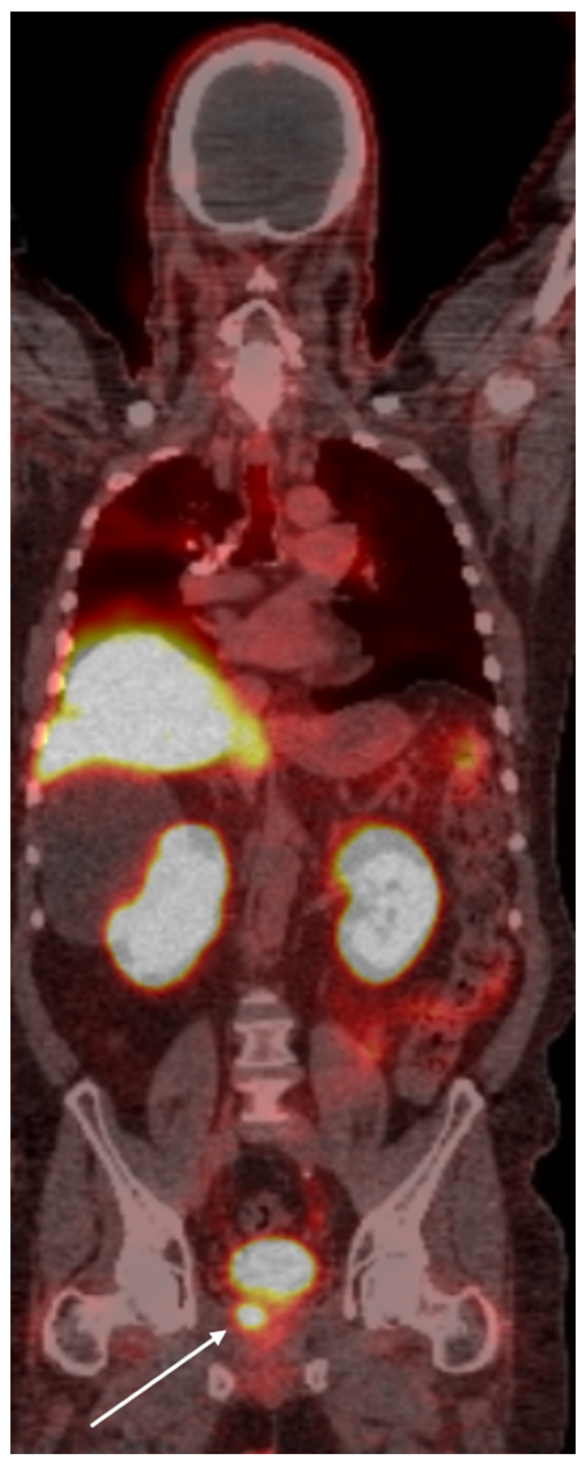 Cancers 16 03039 g001