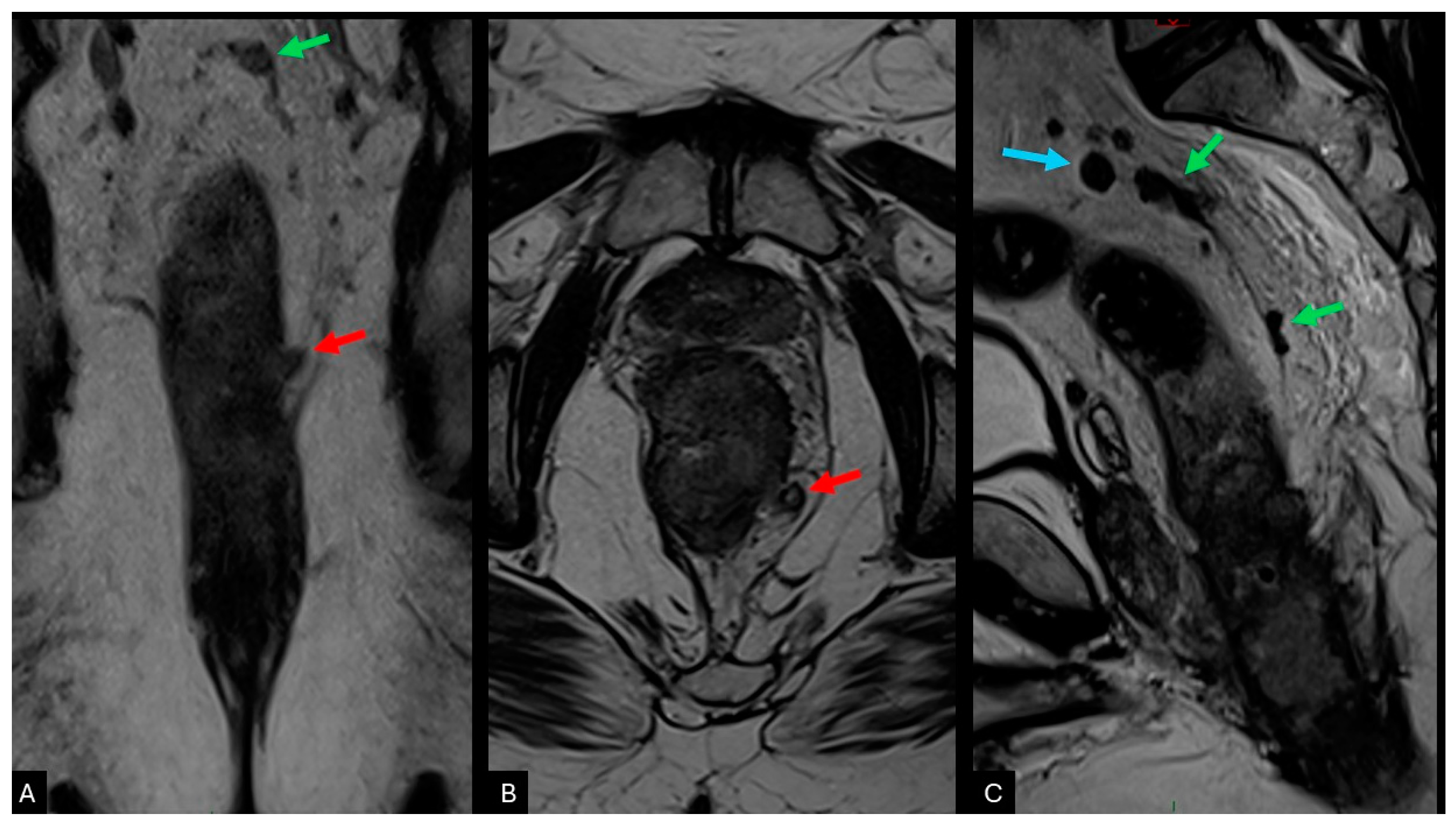 Cancers 16 03111 g002 Cancers 16 03111 g002
