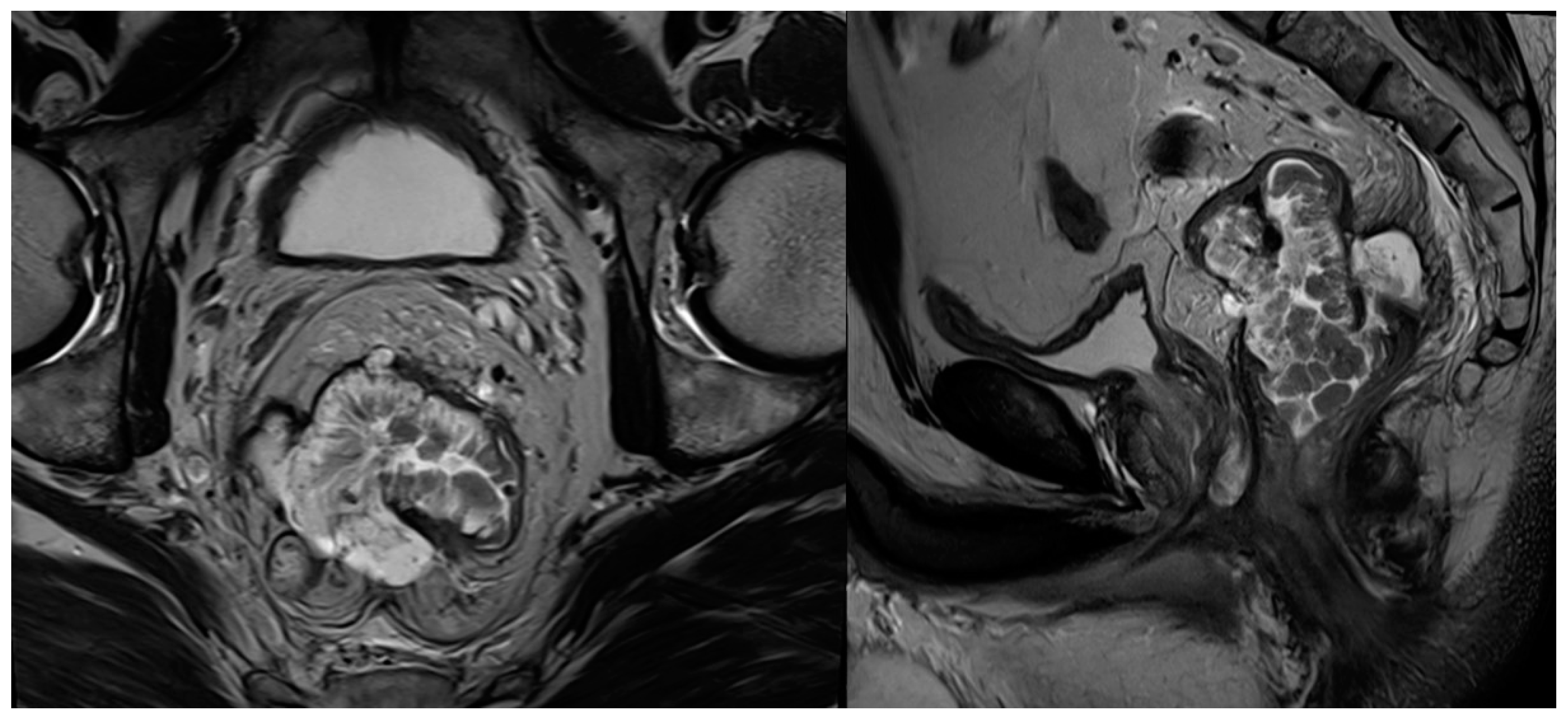 Cancers 16 03111 g004 Cancers 16 03111 g004