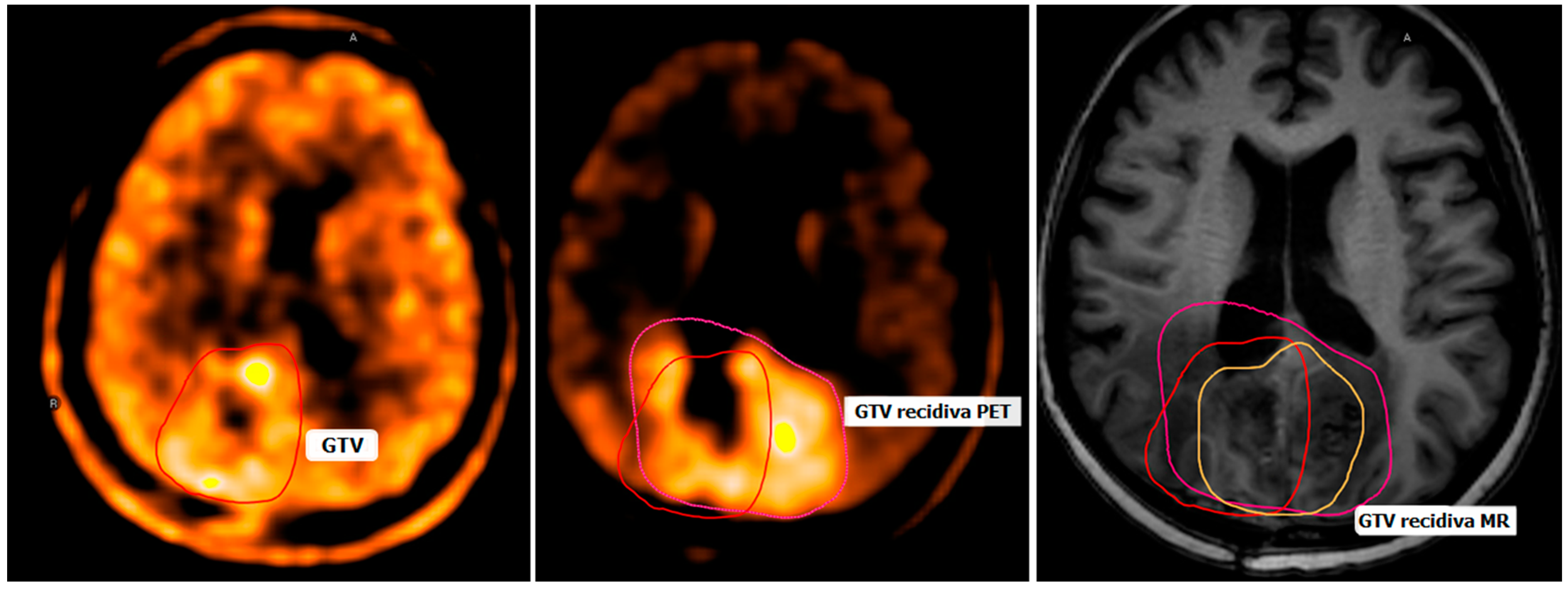 Cancers 16 03200 g001