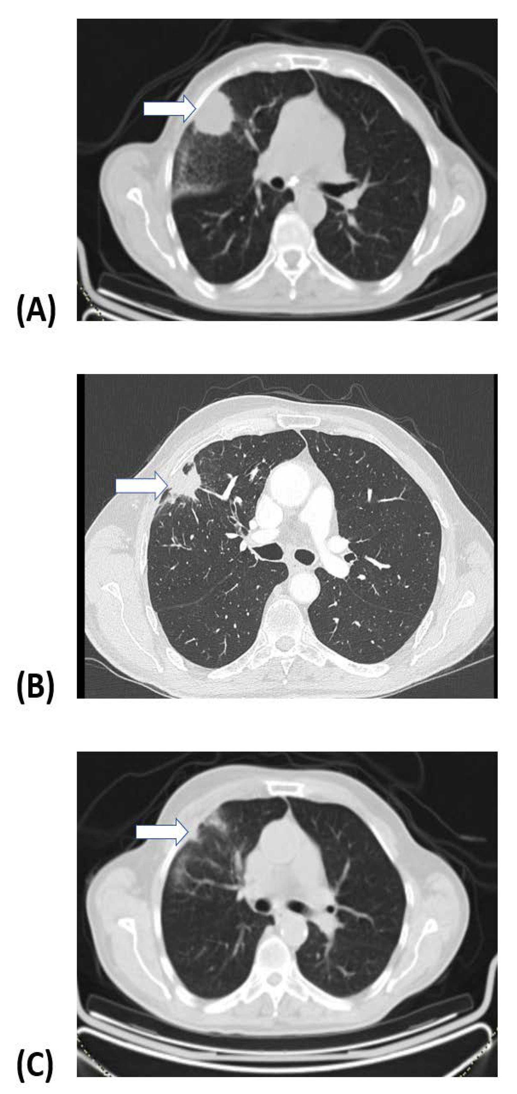 Cancers 16 03227 g002