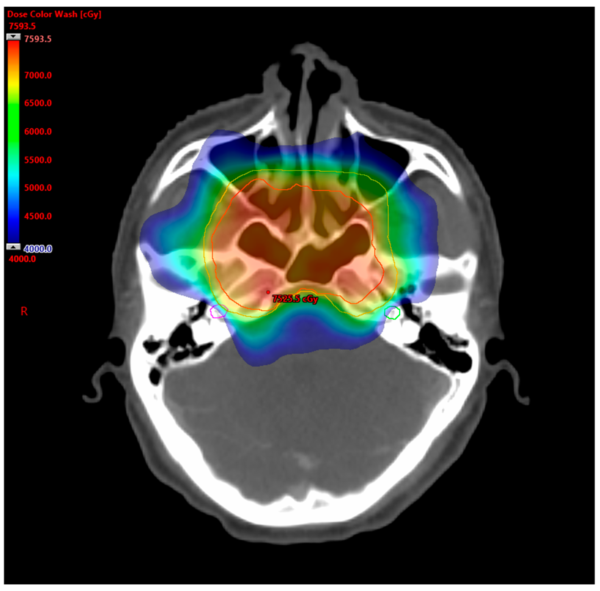 Cancers 16 03237 g001