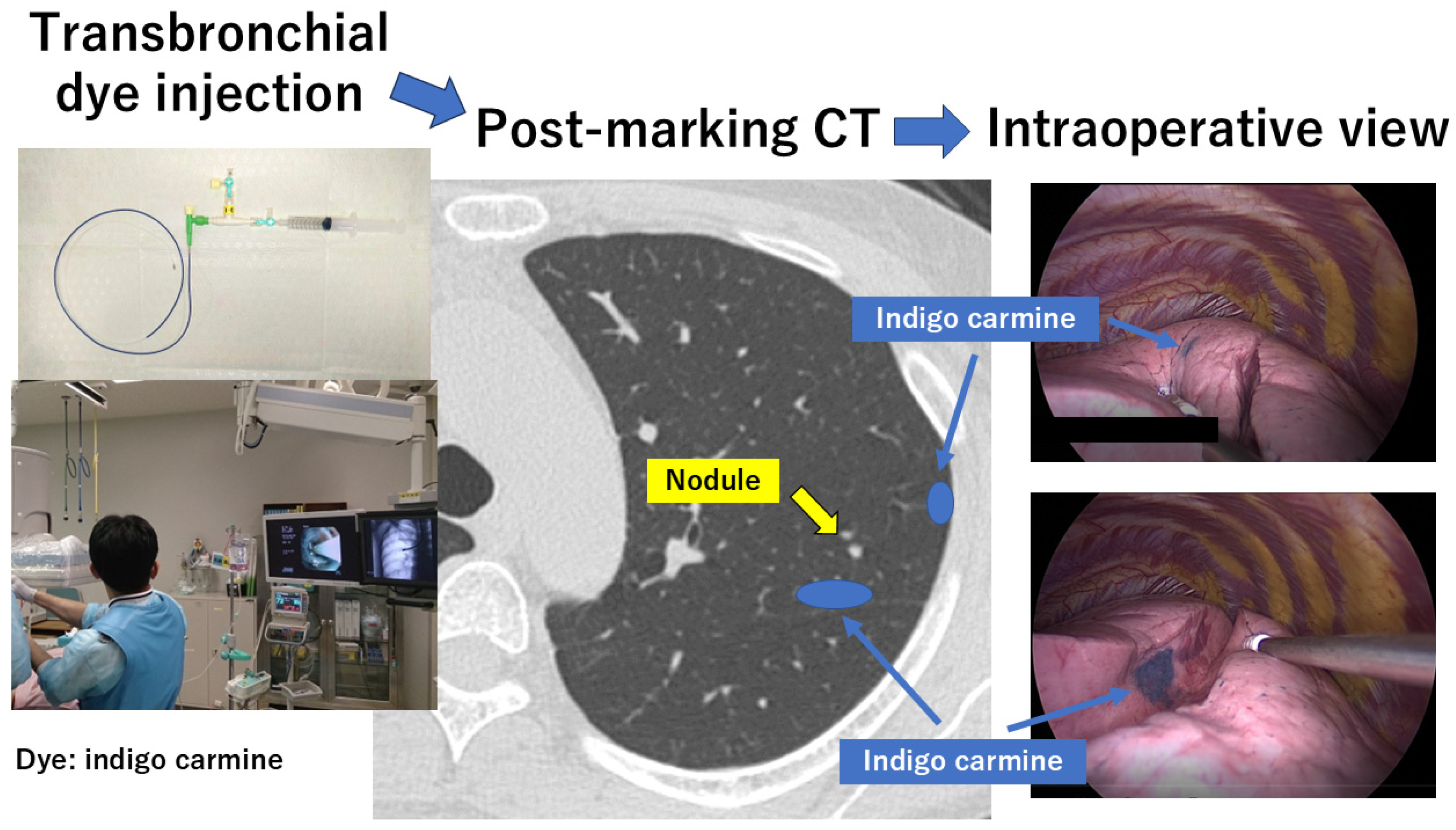 Cancers 16 03284 g002