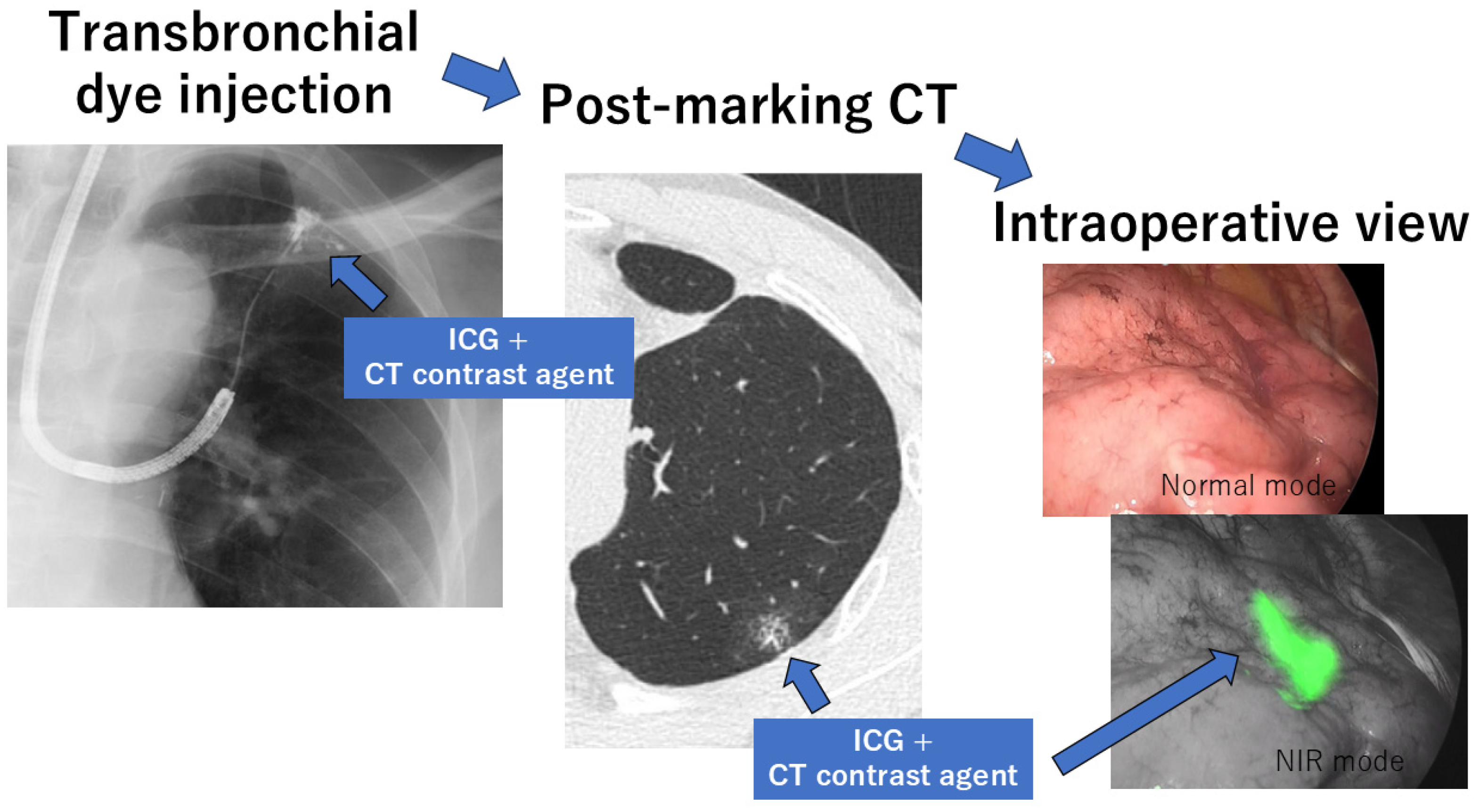 Cancers 16 03284 g003