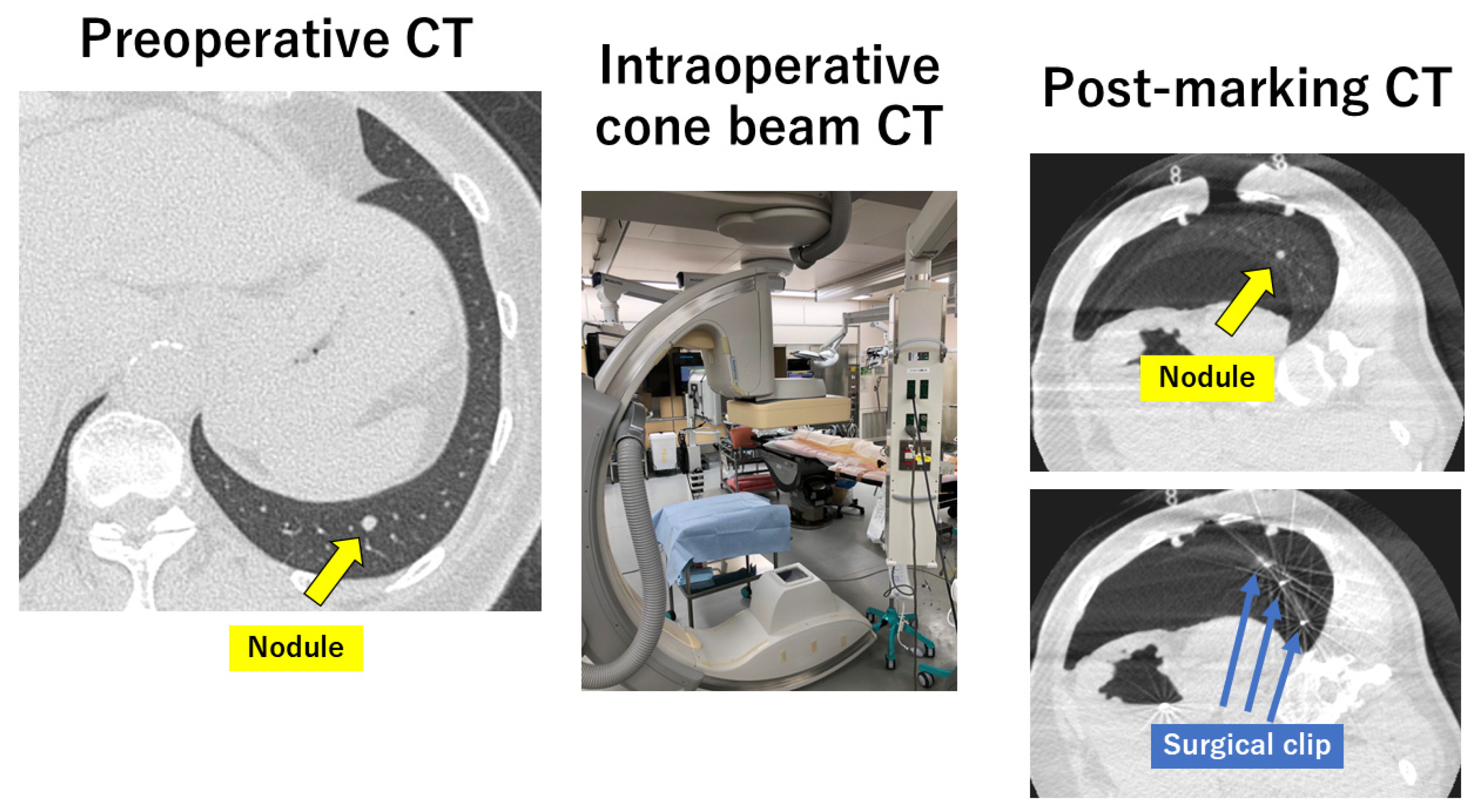Cancers 16 03284 g004