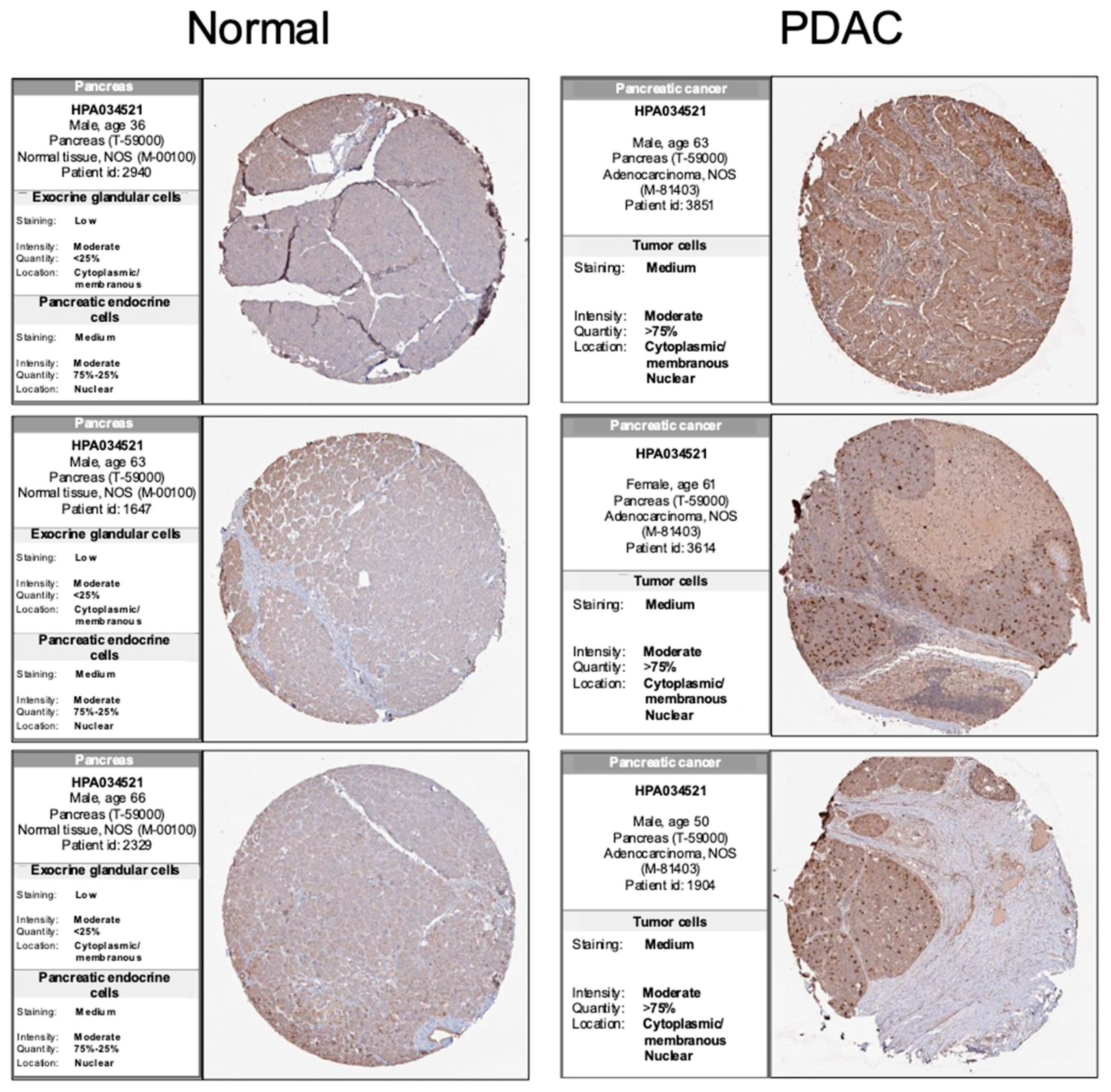 Cancers 16 03310 g005