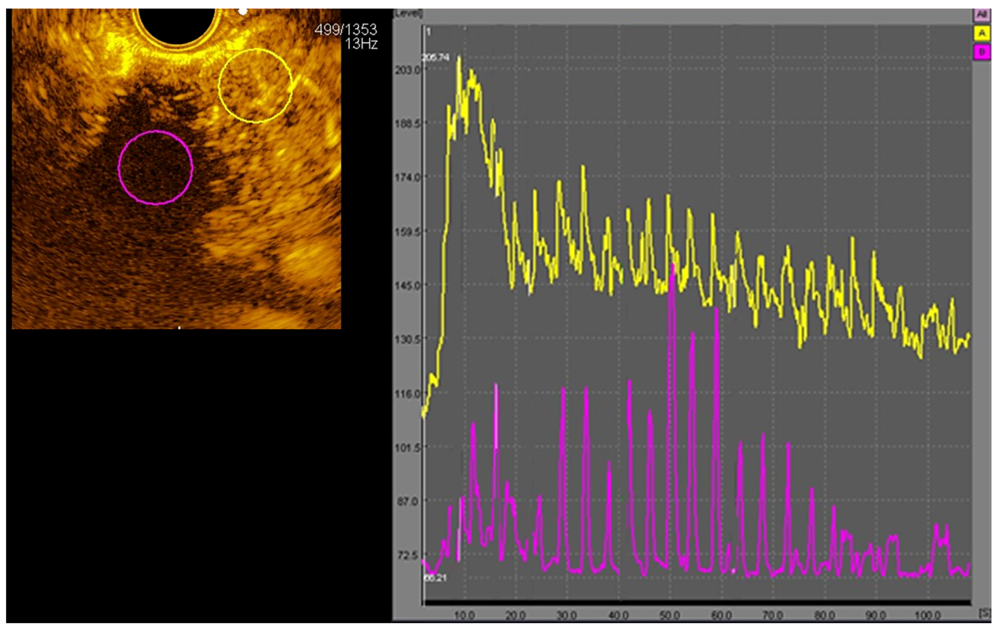 Cancers 16 03412 g001