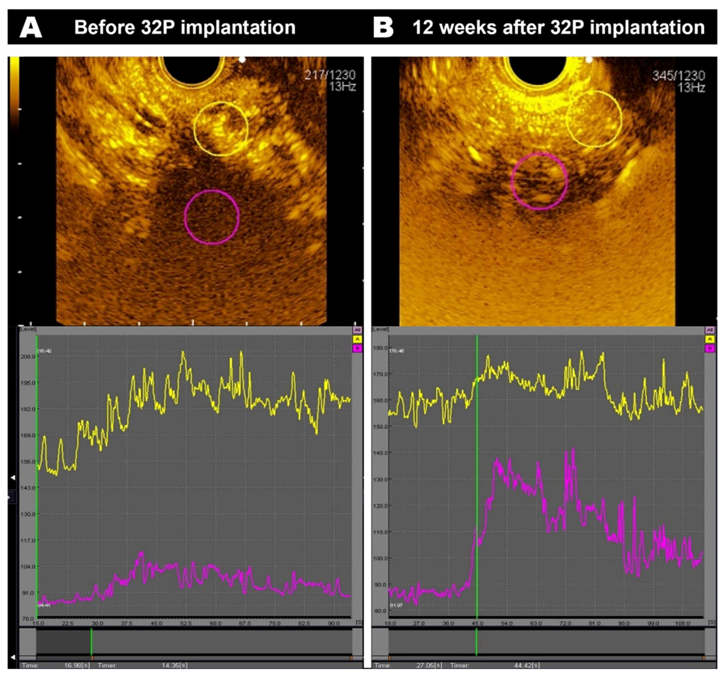 Cancers 16 03412 g003