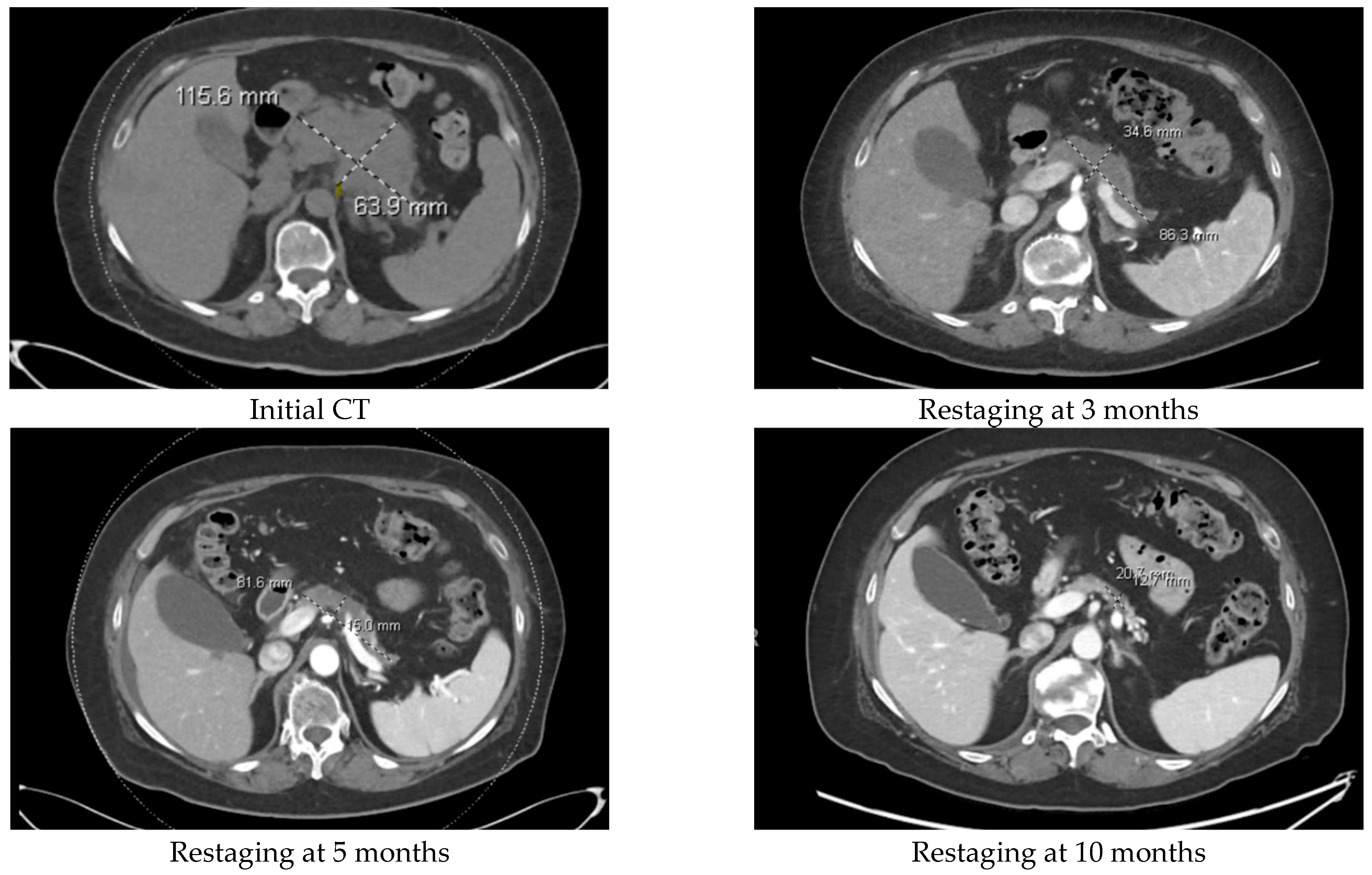 Cancers 16 03421 g002a