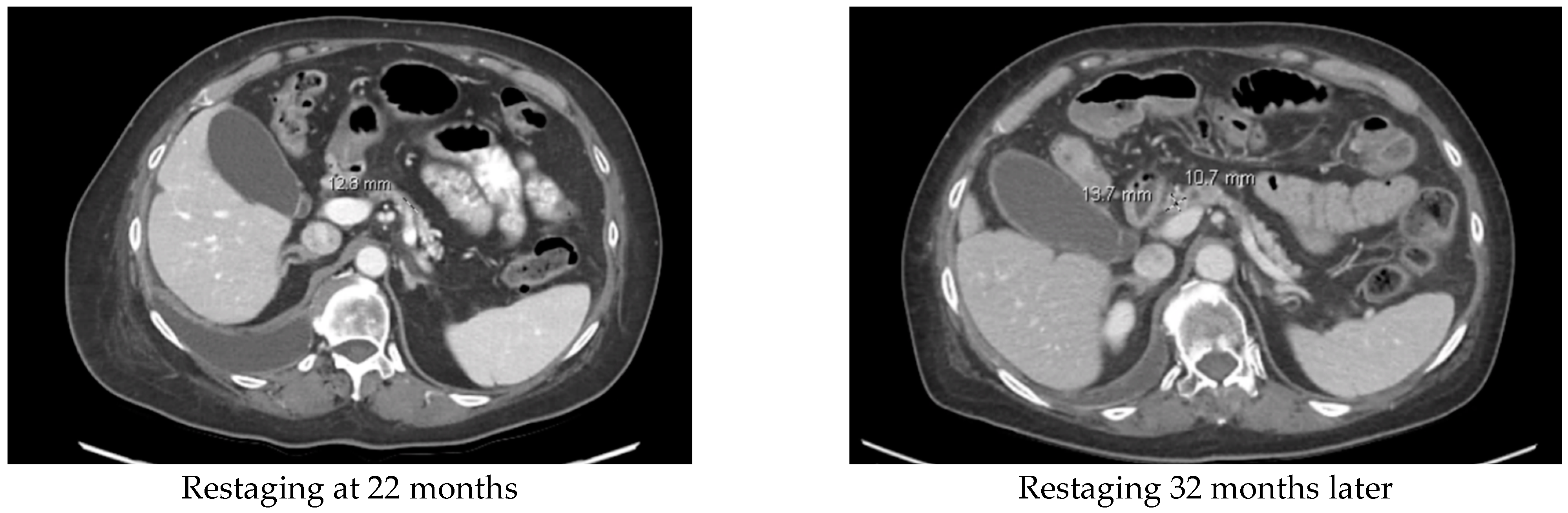 Cancers 16 03421 g002b