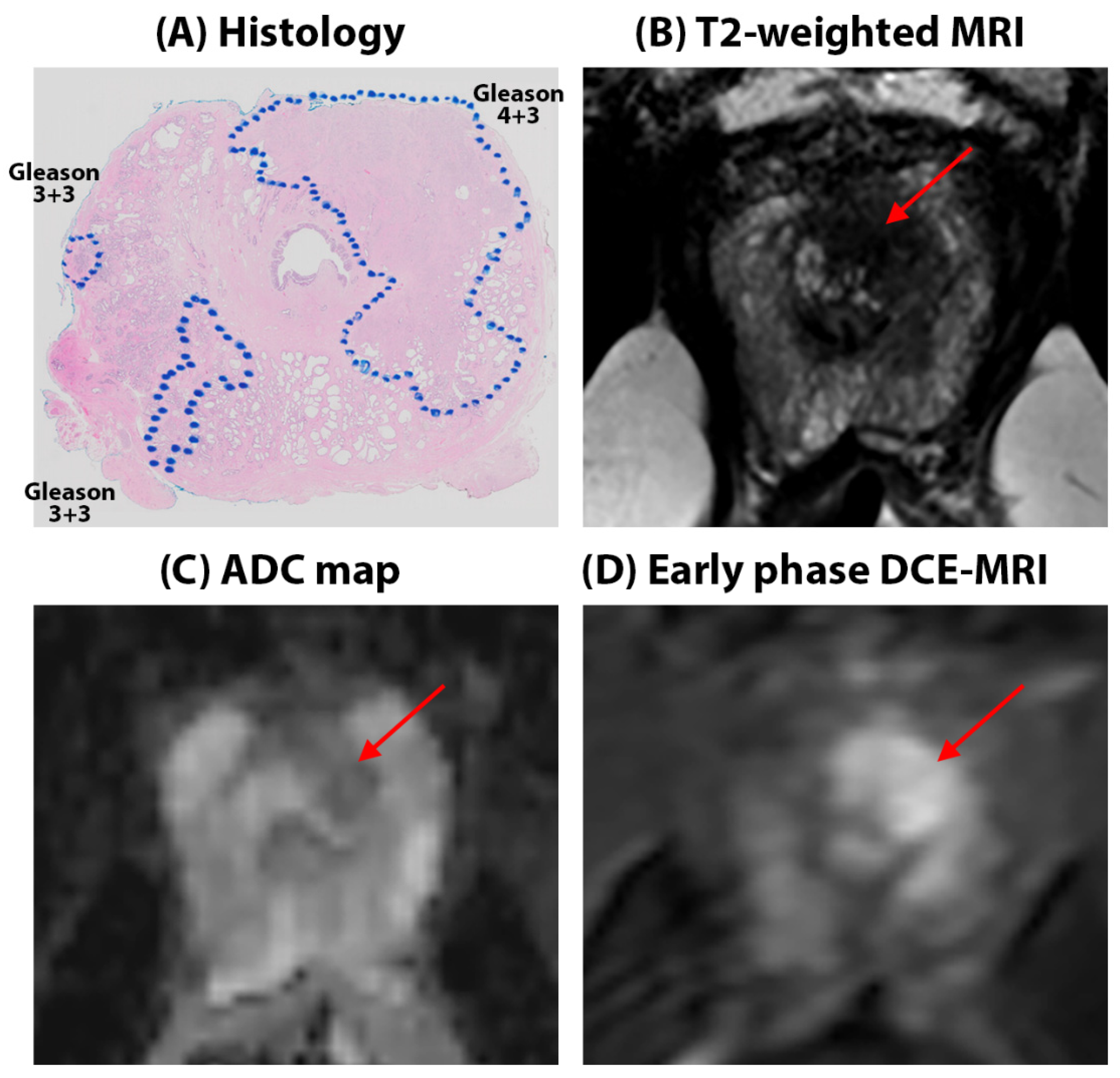 Cancers 16 03499 g001