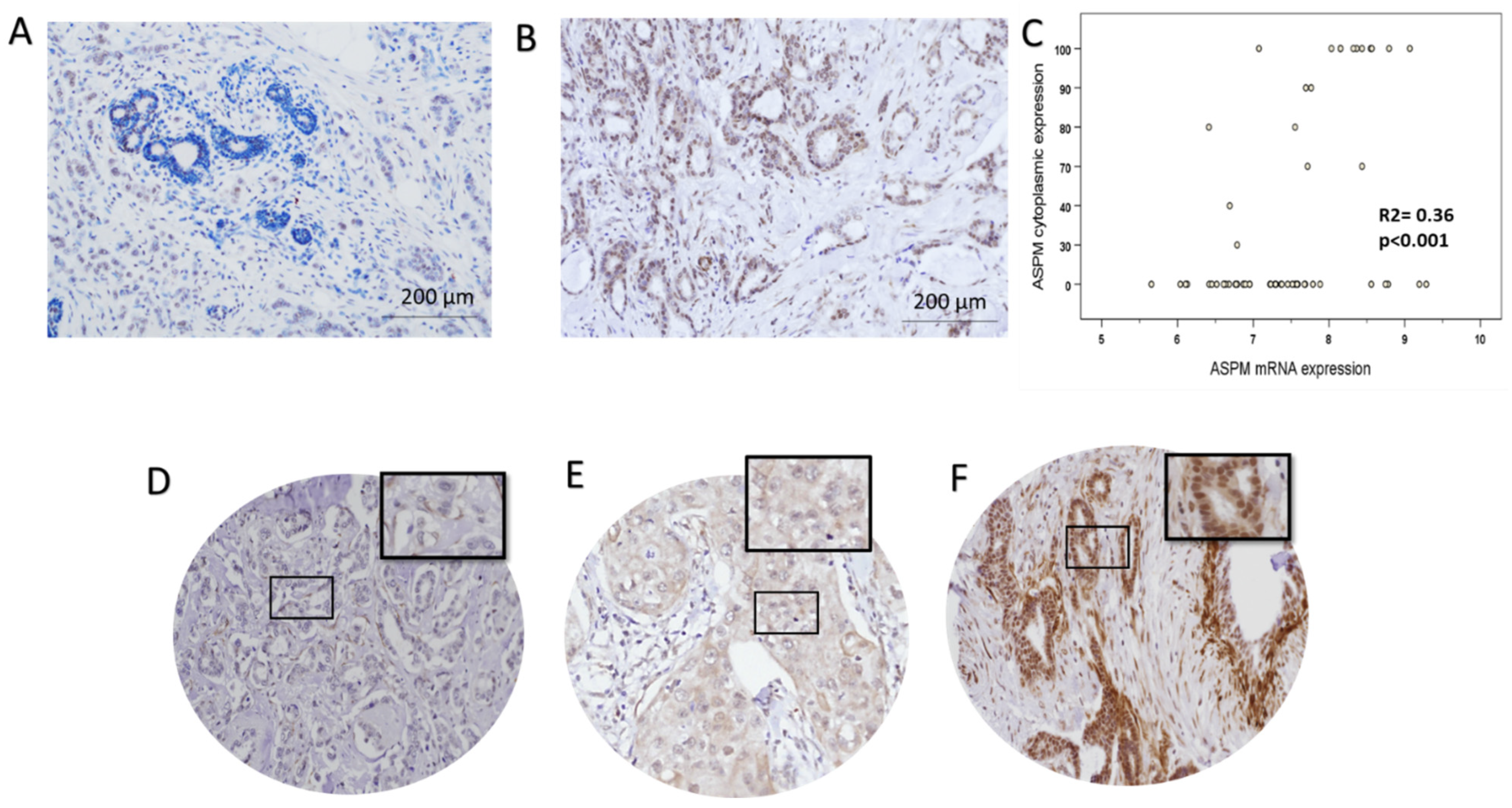 Cancers 16 03814 g003