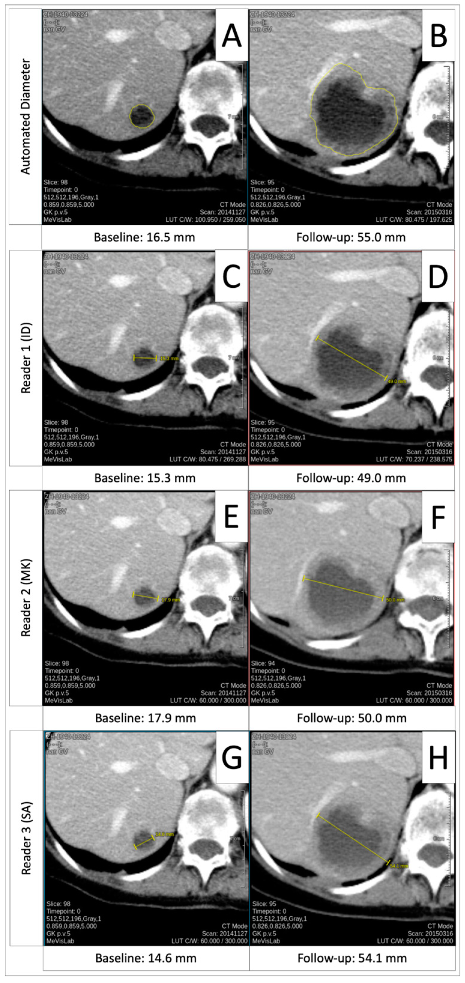 Cancers 16 04009 g002