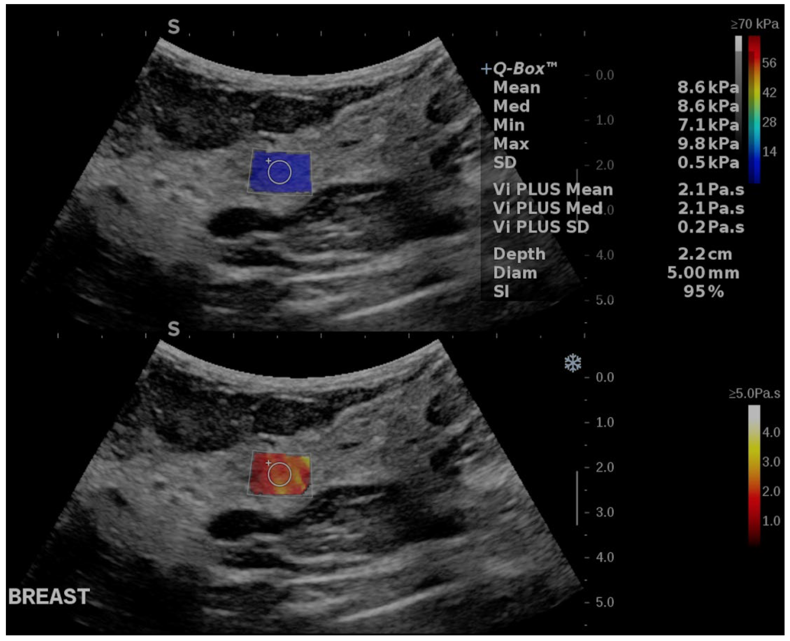 Cancers 17 00237 g001