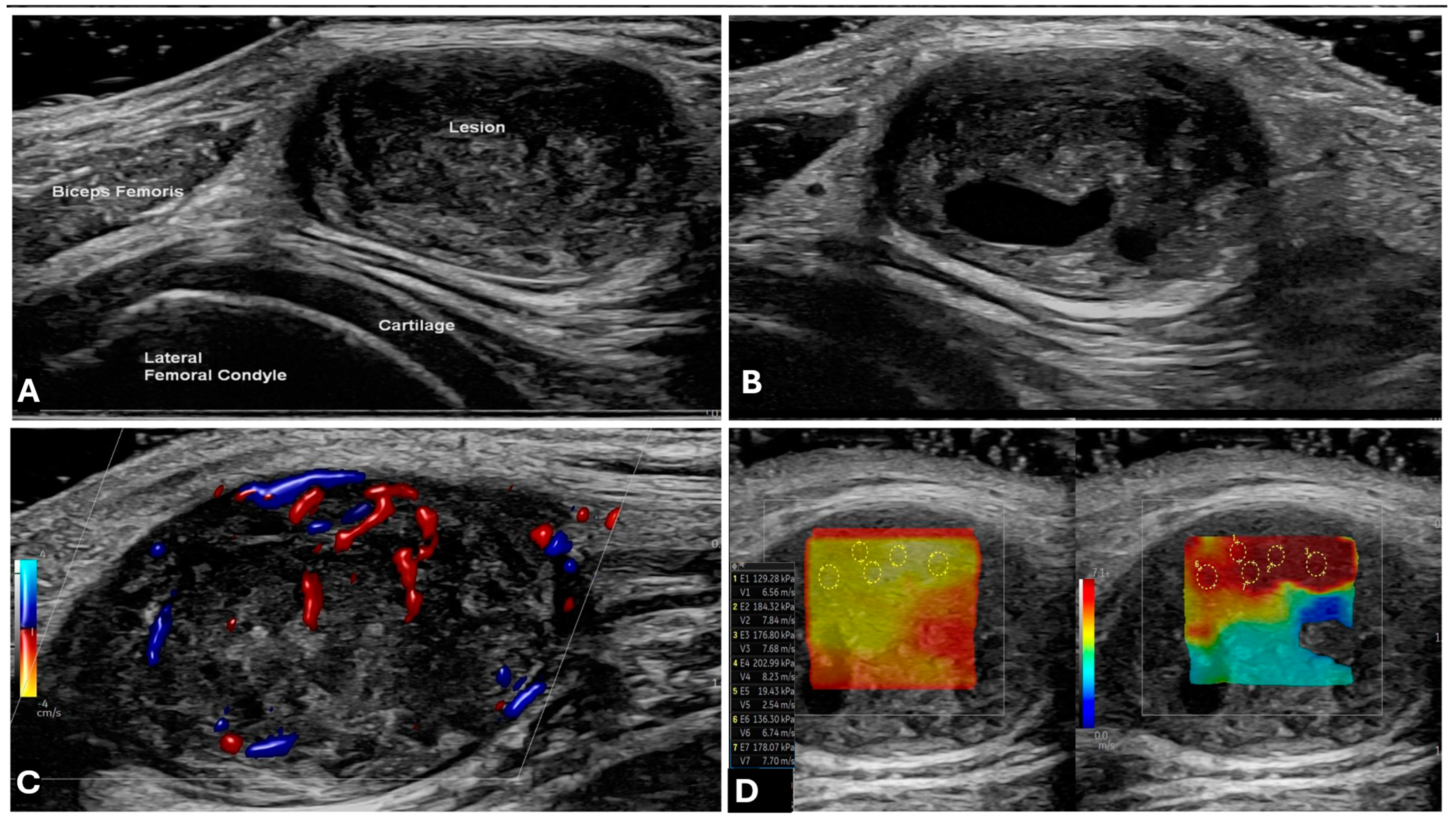 Cancers 17 00246 g002 Cancers 17 00246 g002