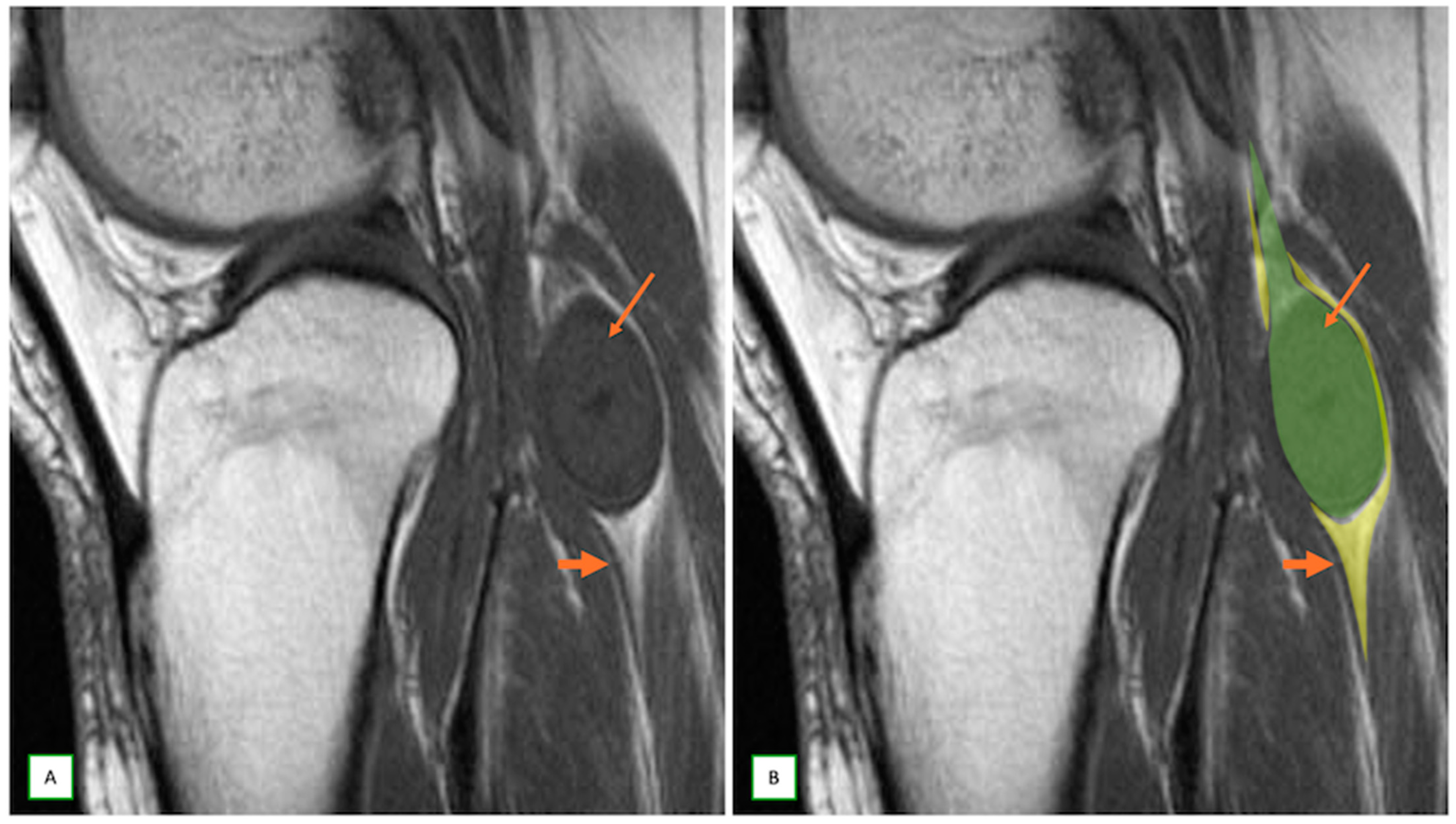 Cancers 17 00246 g003 Cancers 17 00246 g003