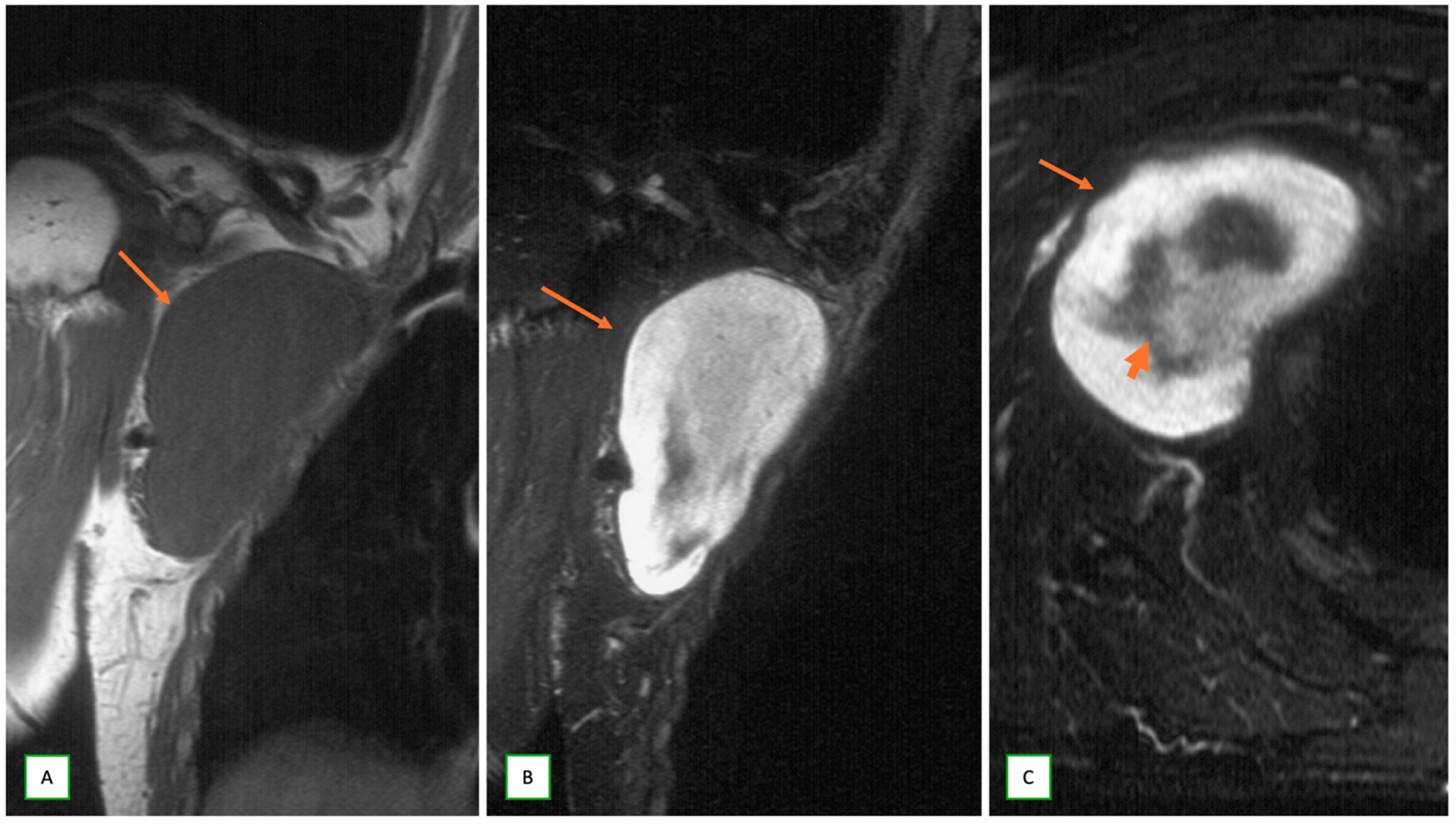 Cancers 17 00246 g005 Cancers 17 00246 g005