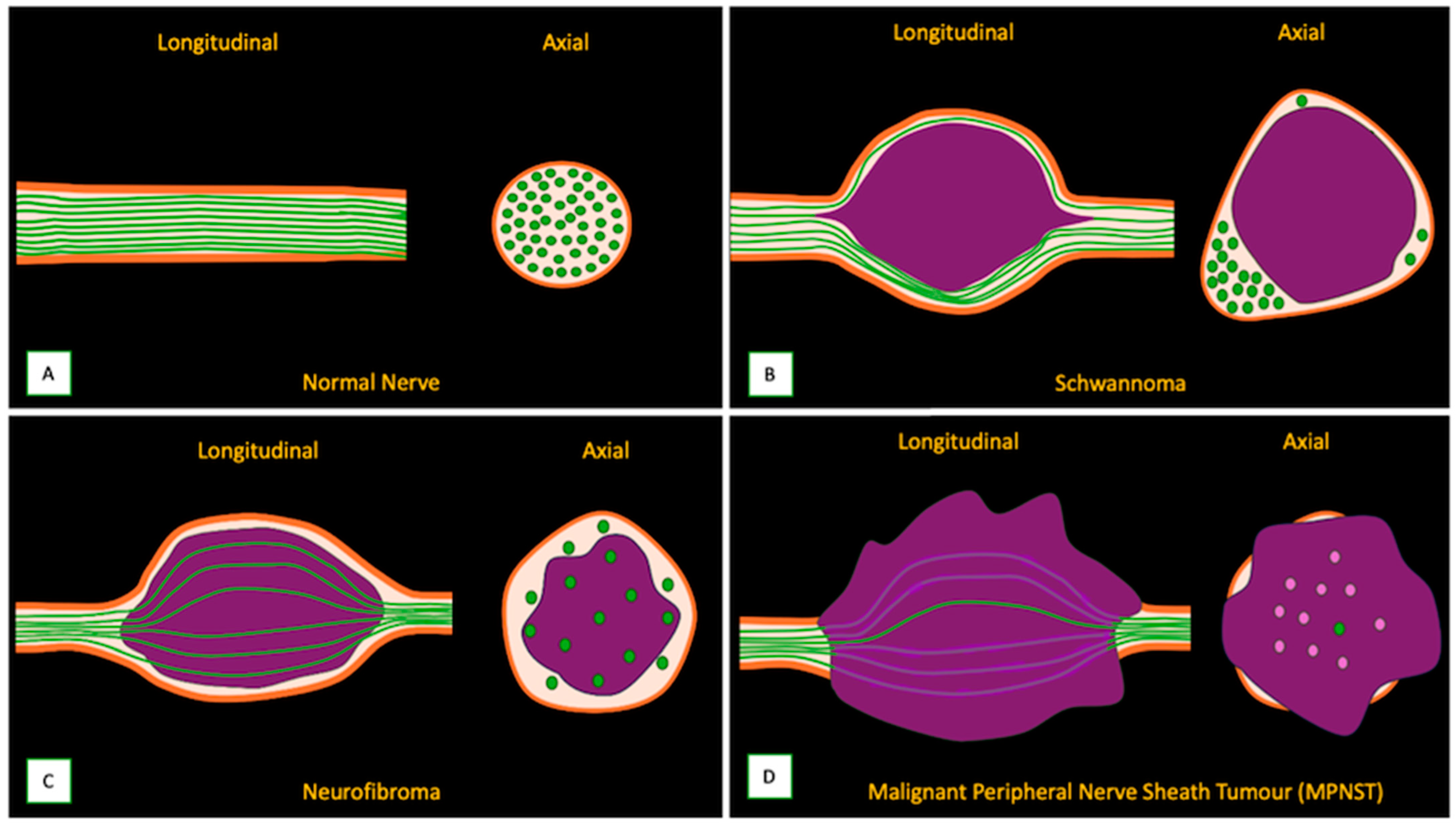 Cancers 17 00246 g007 Cancers 17 00246 g007