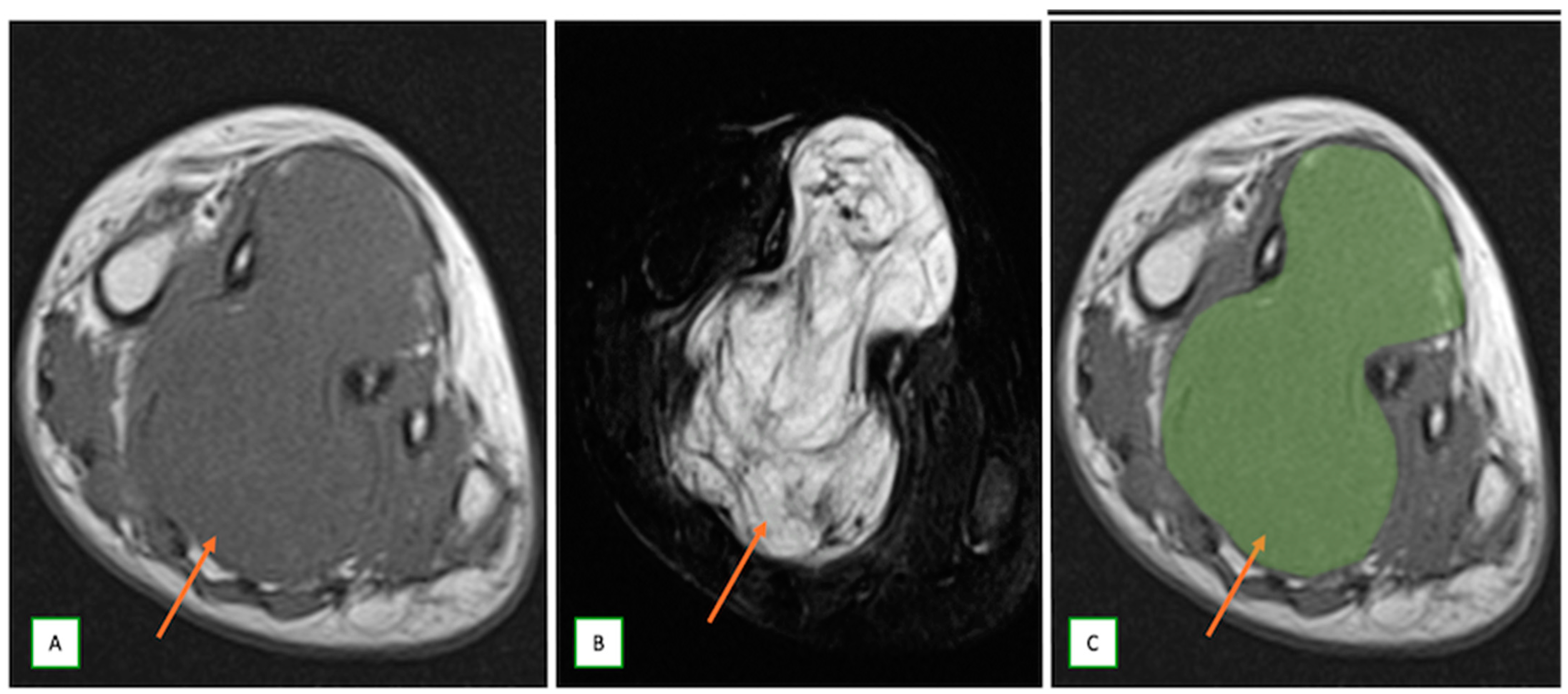 Cancers 17 00246 g010 Cancers 17 00246 g010