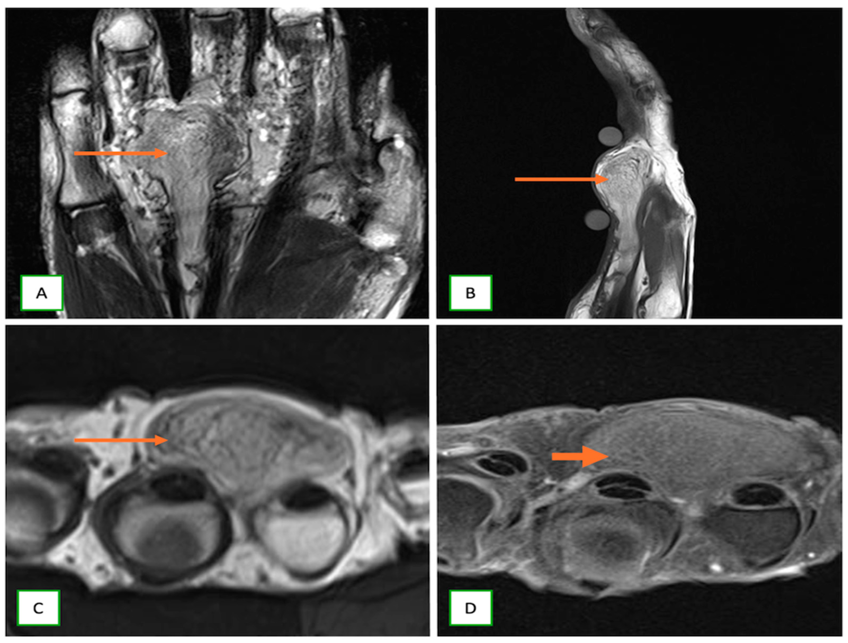 Cancers 17 00246 g015 Cancers 17 00246 g015