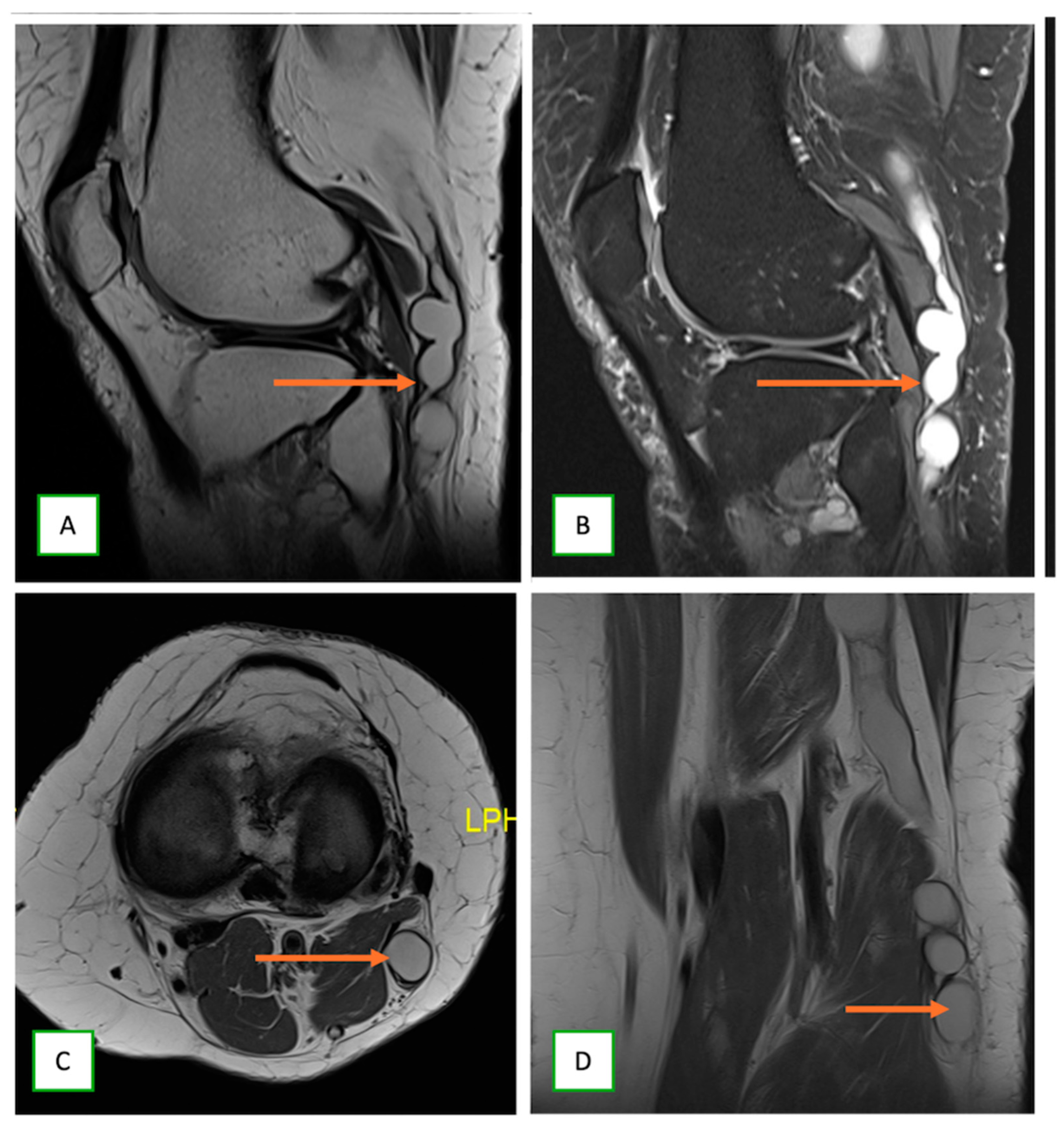 Cancers 17 00246 g016 Cancers 17 00246 g016