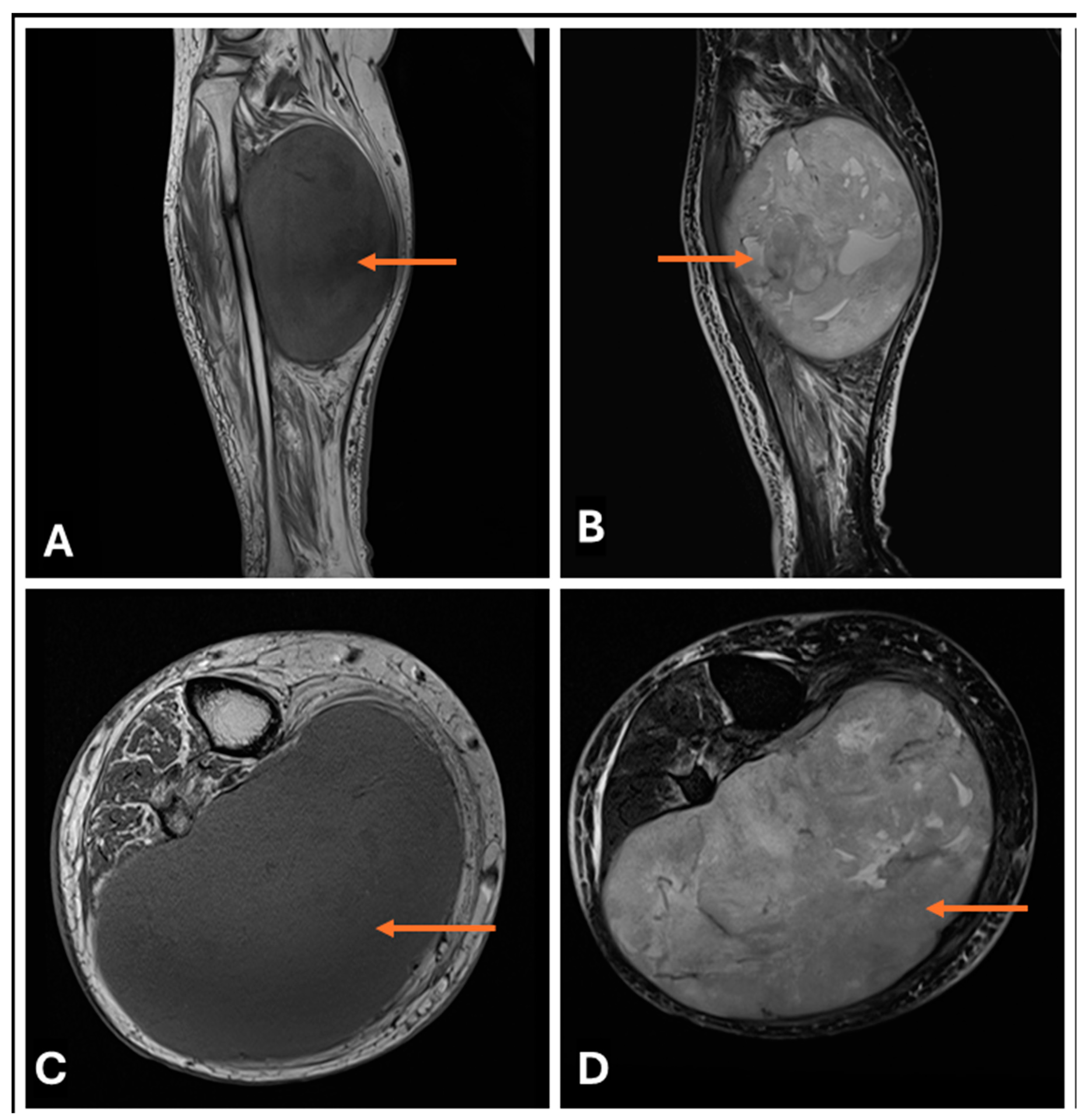 Cancers 17 00246 g018 Cancers 17 00246 g018