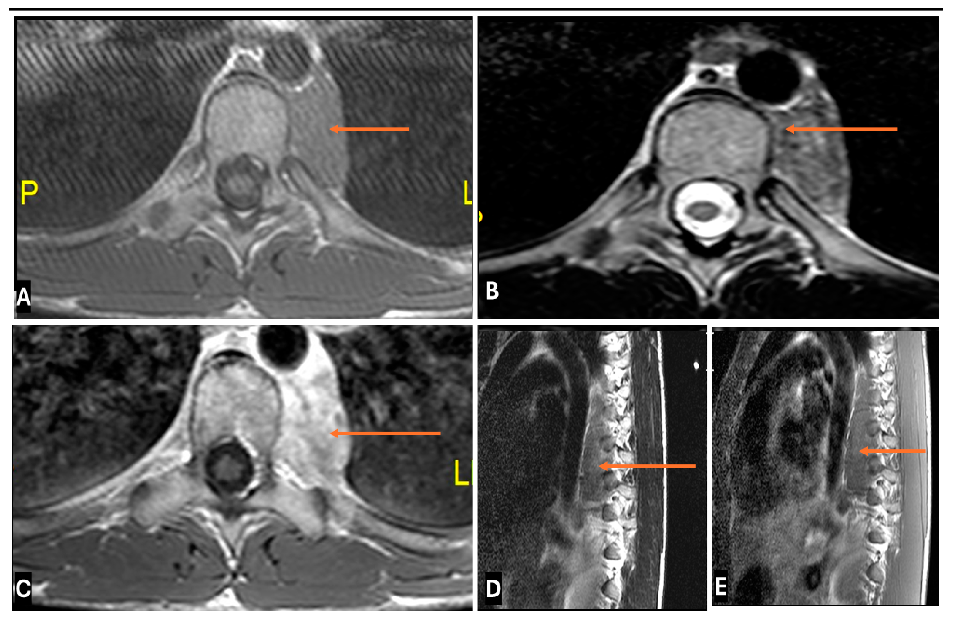 Cancers 17 00246 g019 Cancers 17 00246 g019