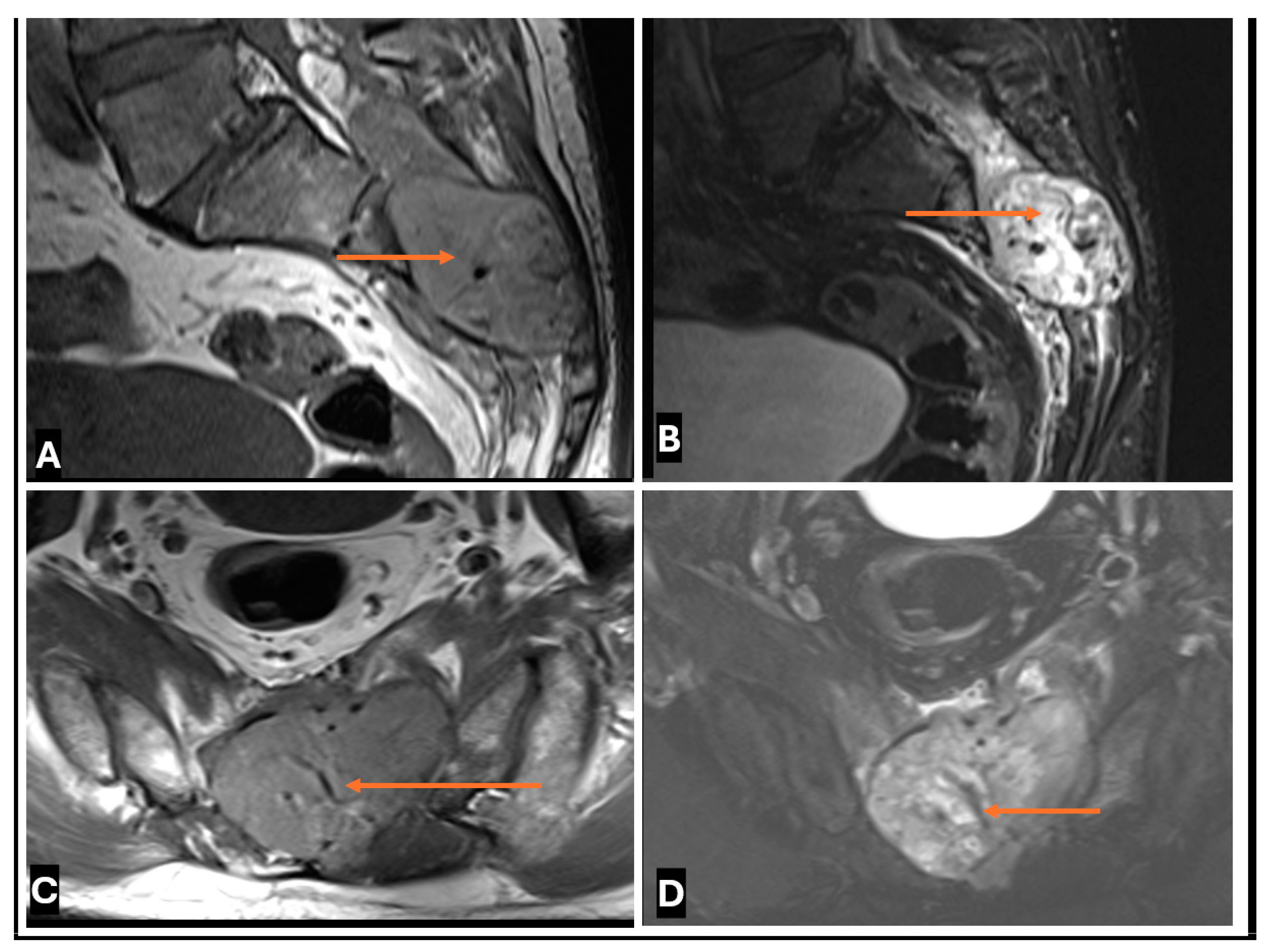 Cancers 17 00246 g022 Cancers 17 00246 g022