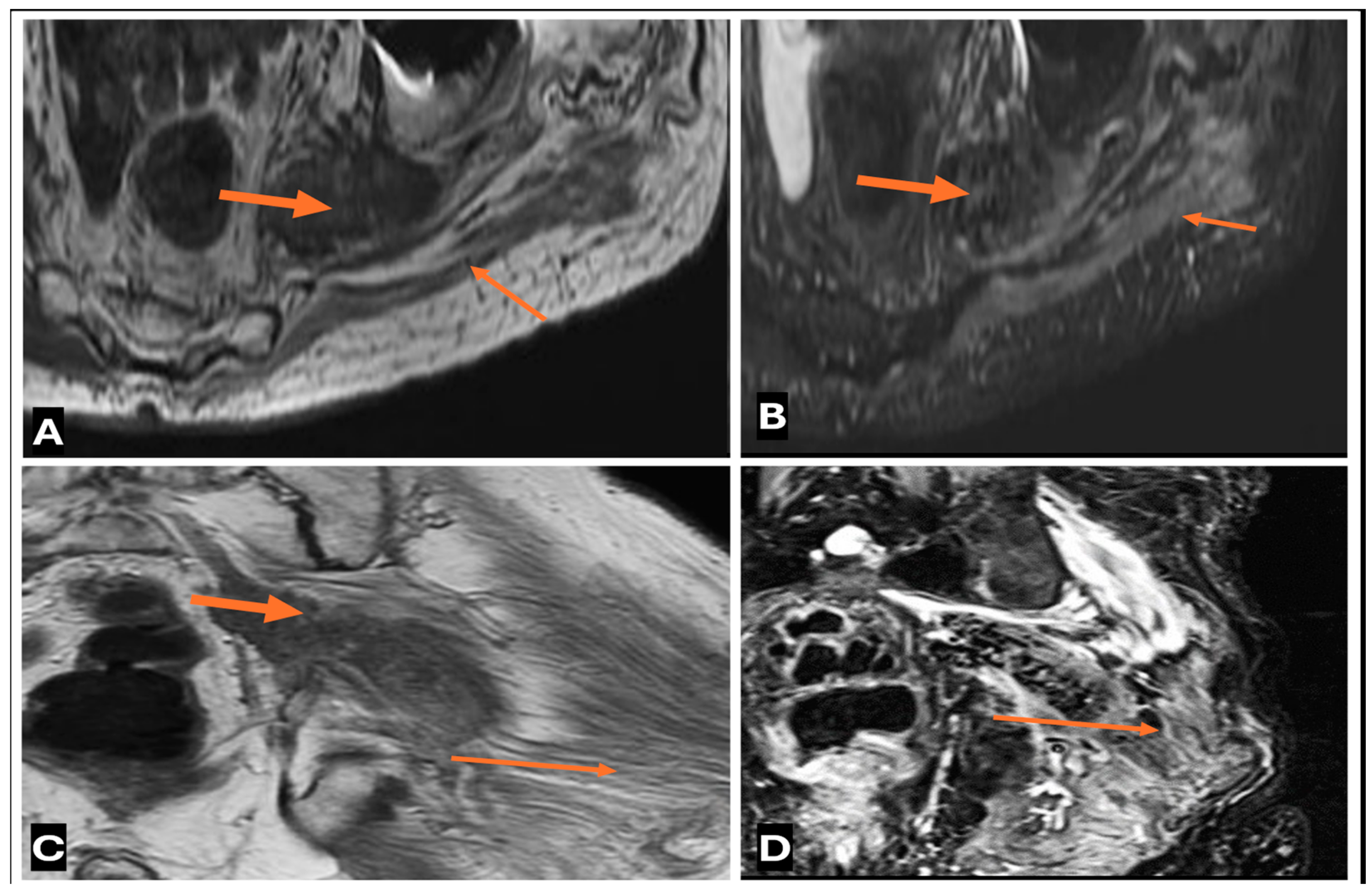 Cancers 17 00246 g025 Cancers 17 00246 g025