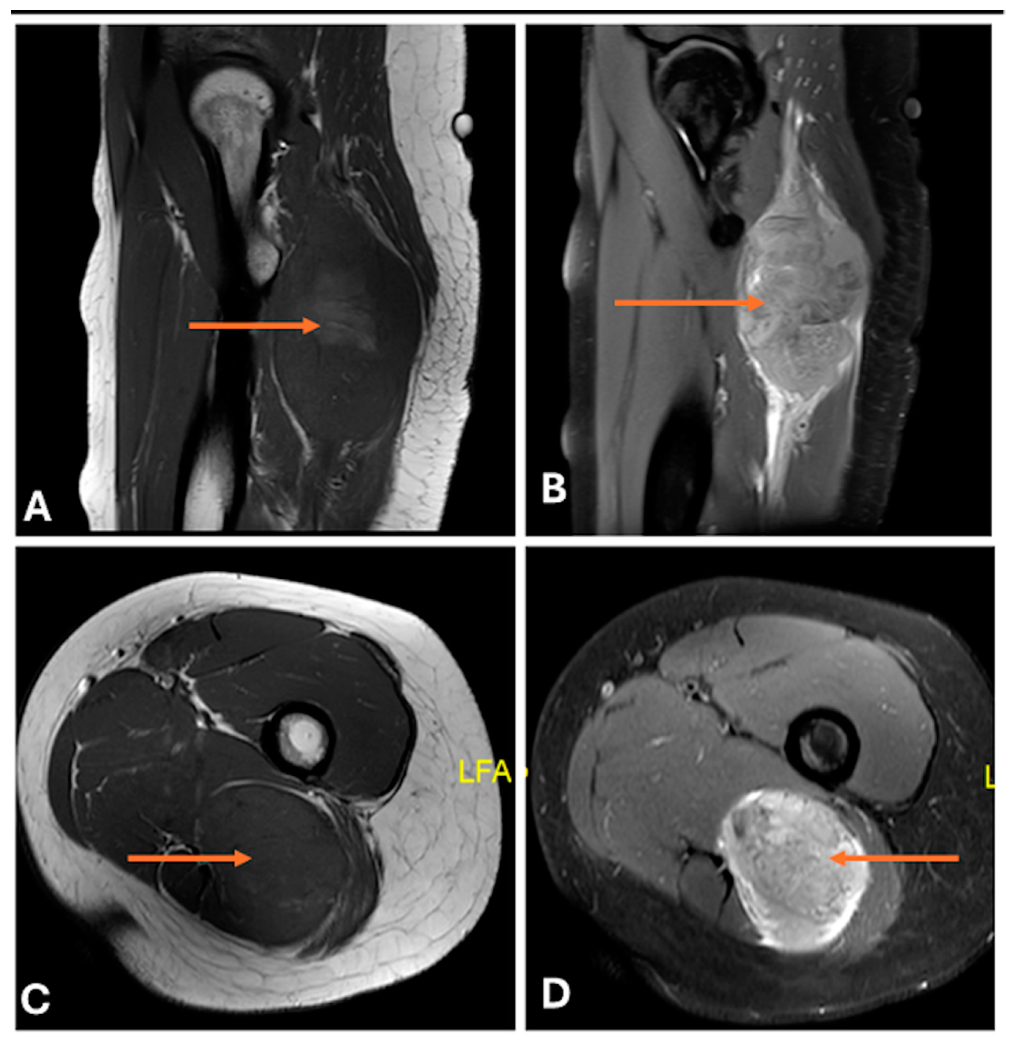 Cancers 17 00246 g026 Cancers 17 00246 g026