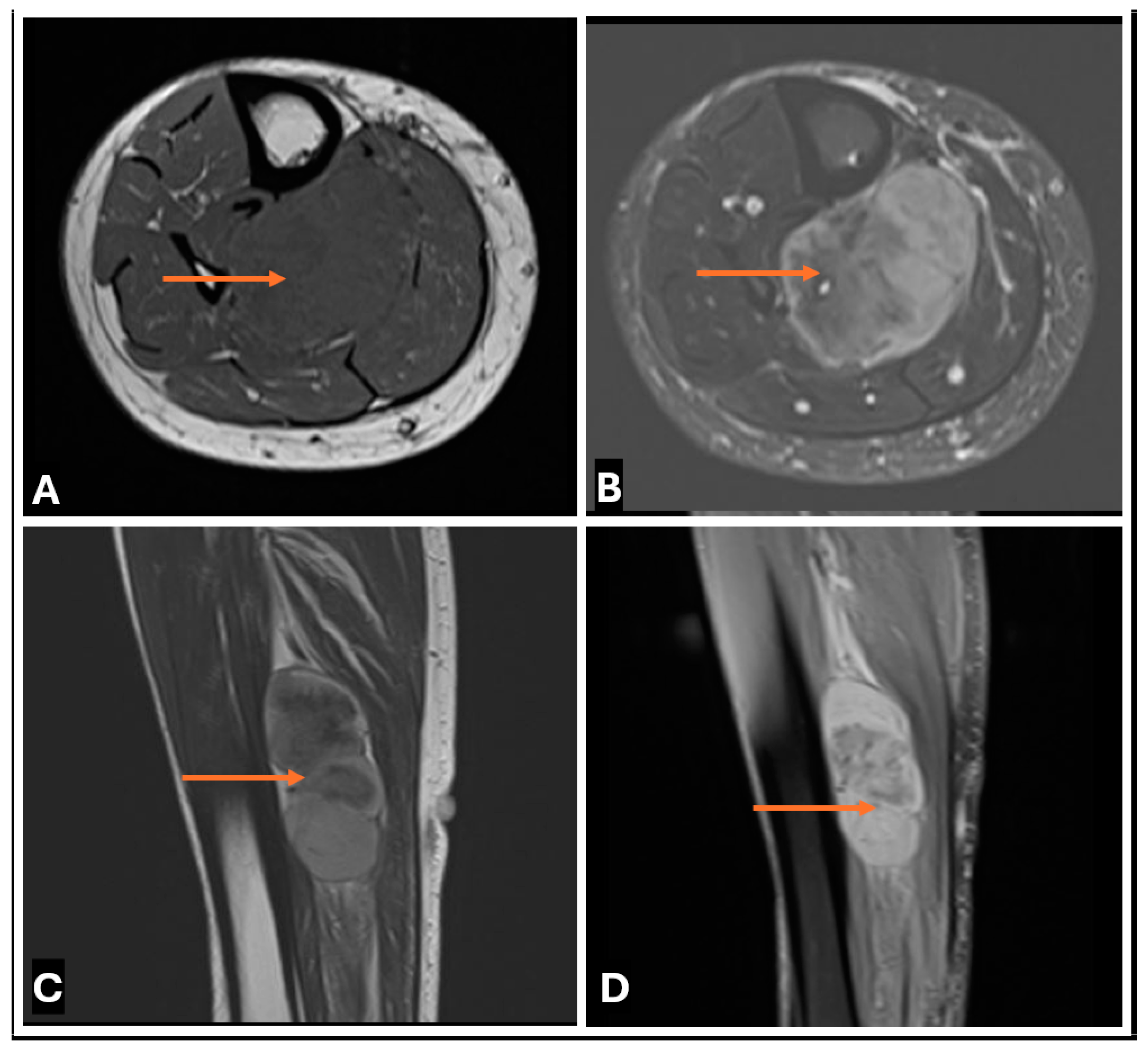 Cancers 17 00246 g028 Cancers 17 00246 g028