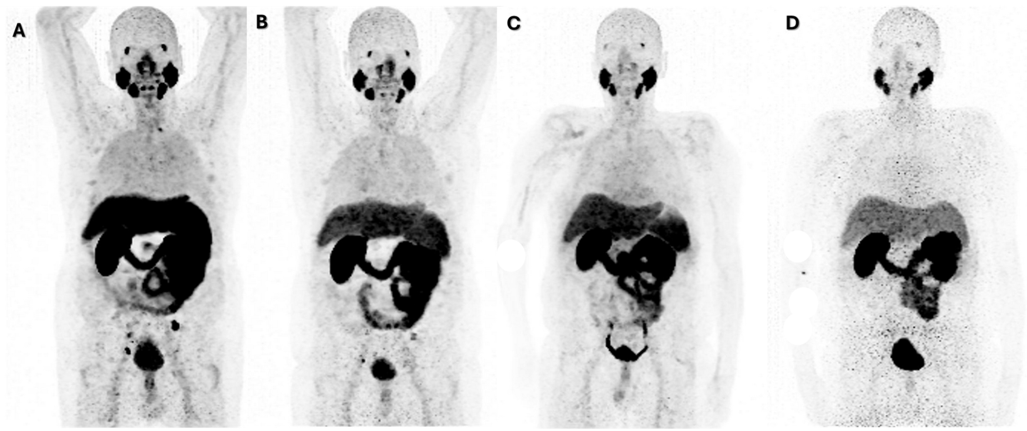 Cancers 17 00476 g002