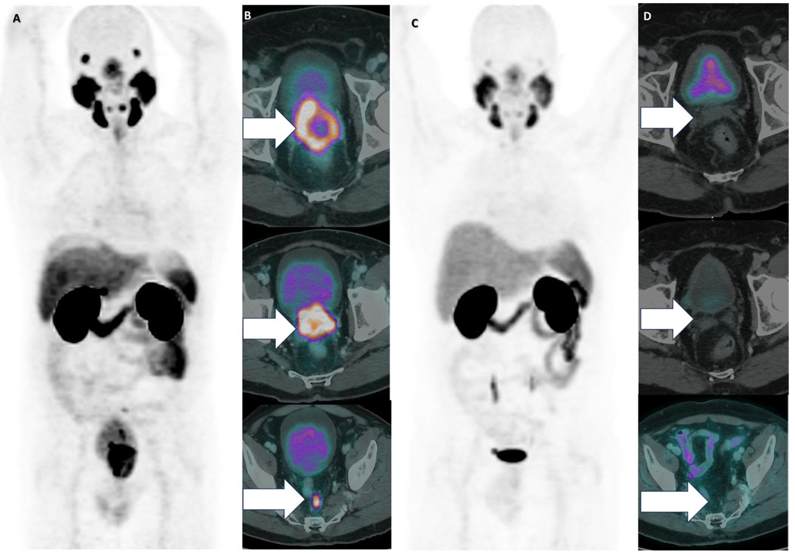 Cancers 17 00476 g003