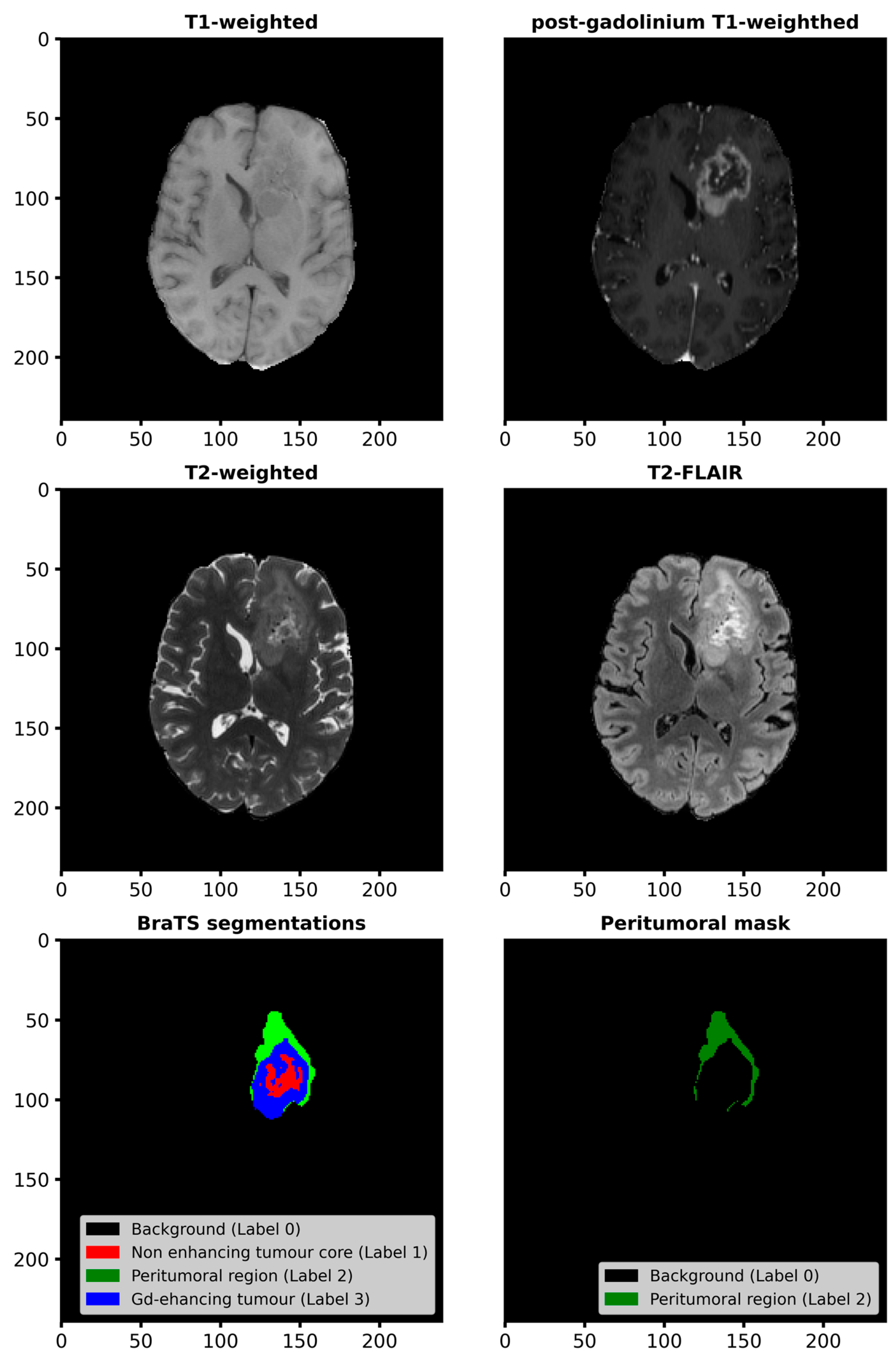 Cancers 17 00478 g001